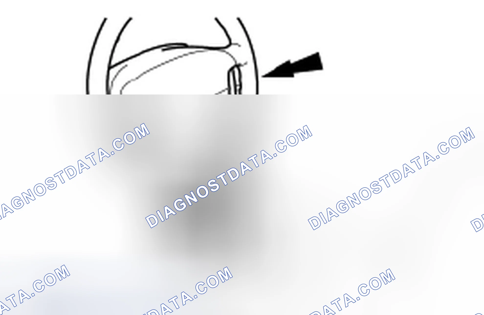 Scheme 1: Removal
