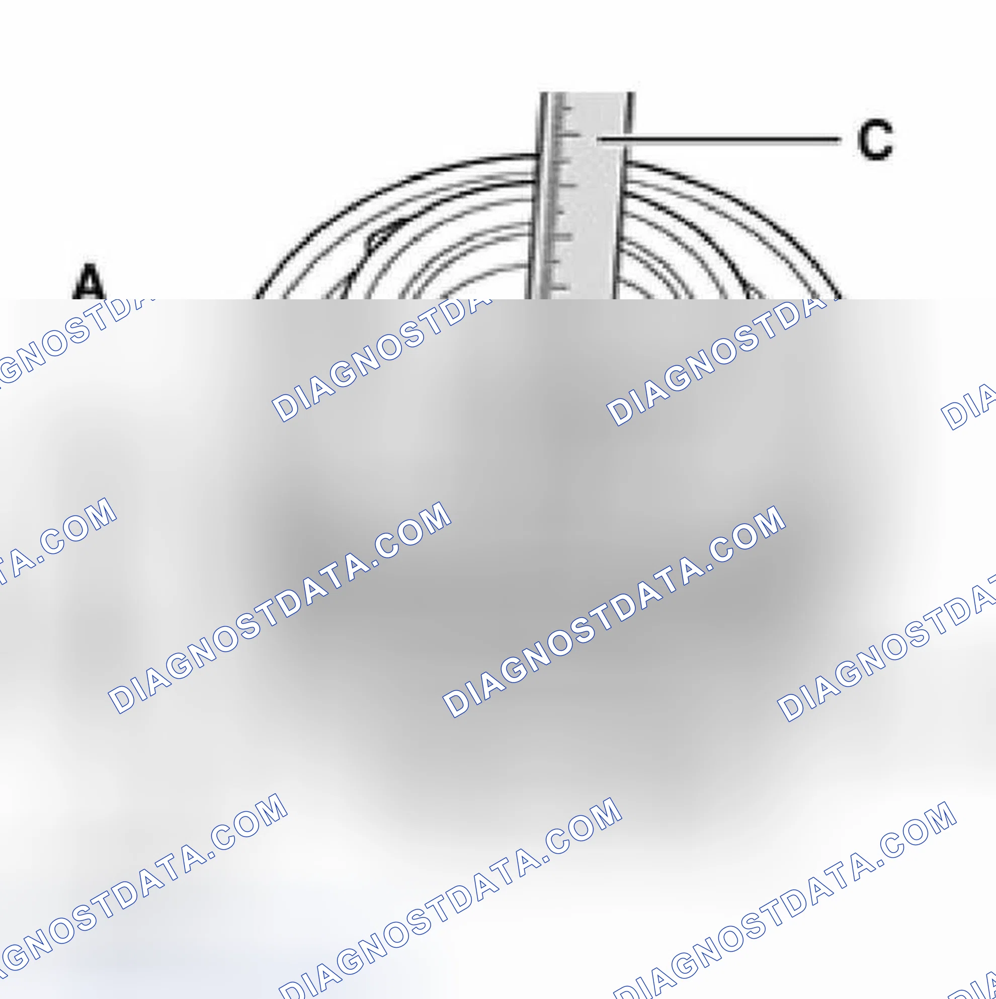 Scheme 28: Checking and adjusting gap