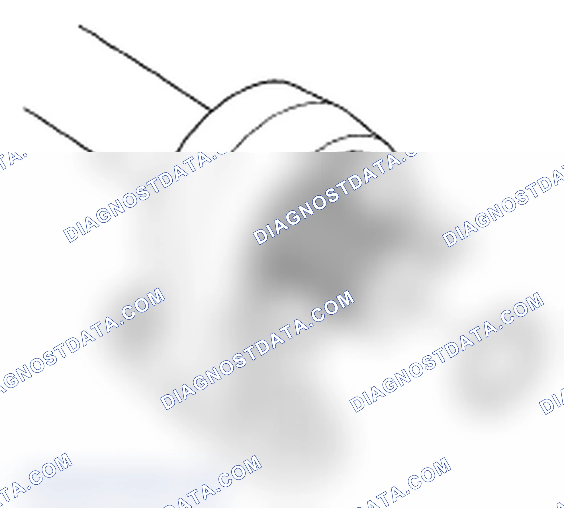 Scheme 75: Intermediate Shaft Installation