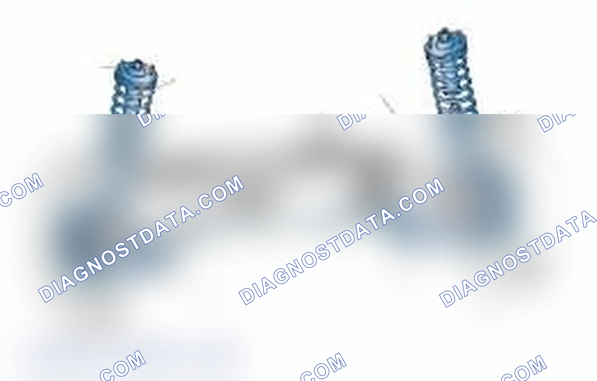 Scheme 25: Typical Front Suspension & Steering Components