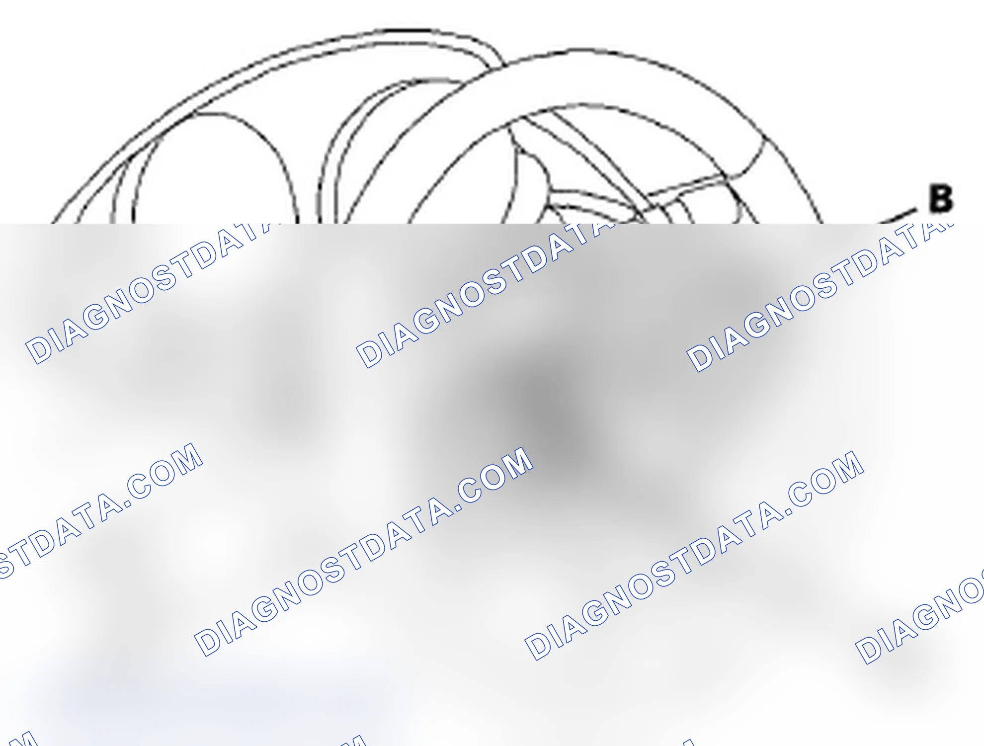 Scheme 6: Steering Wheel Removal