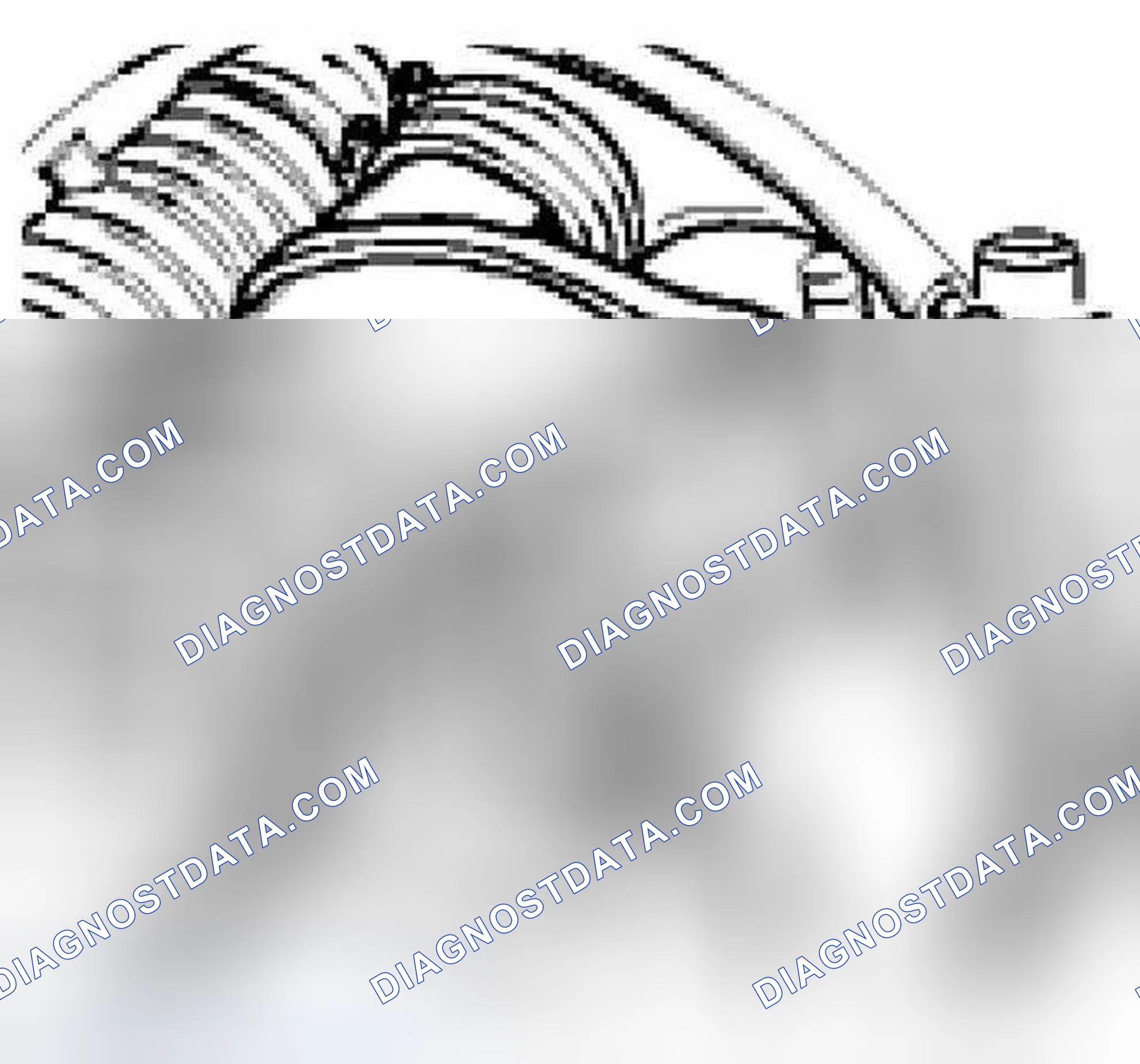Scheme 34: Installing throttle body - Boxster S