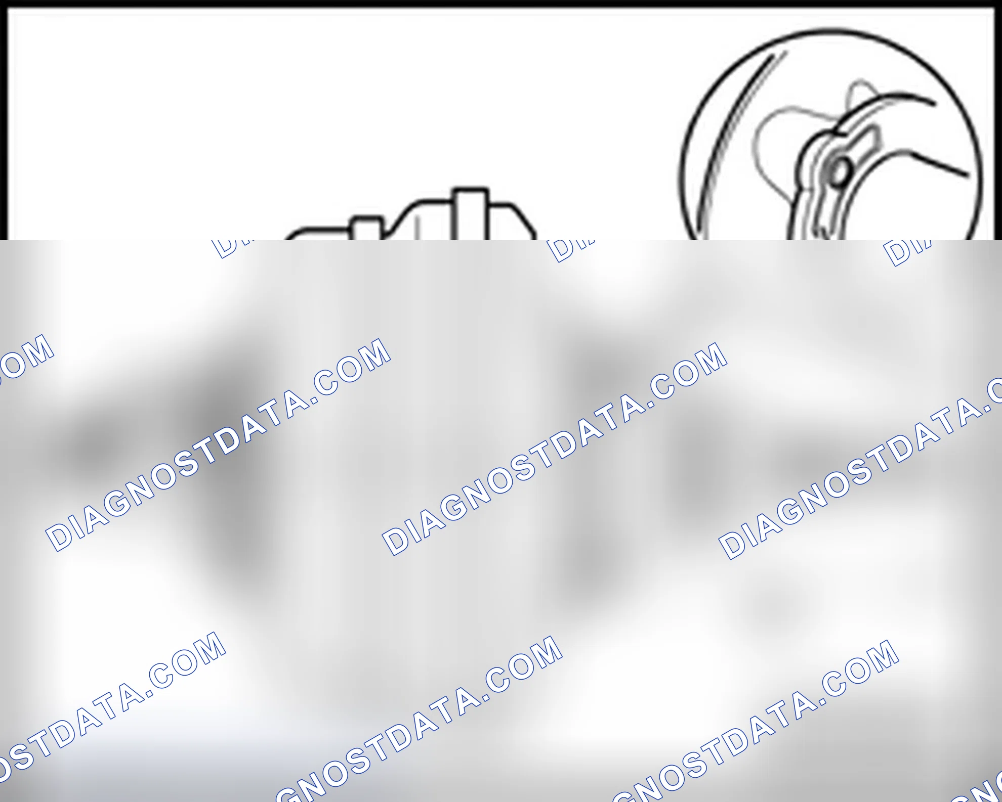 Scheme 156: Ball head, adjusting