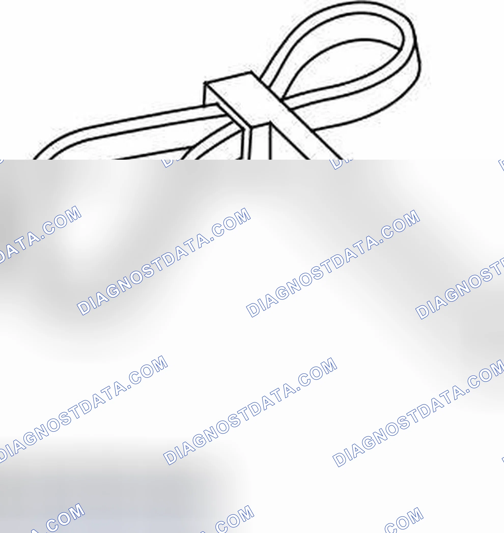 Scheme 390: Engine - Disassembly