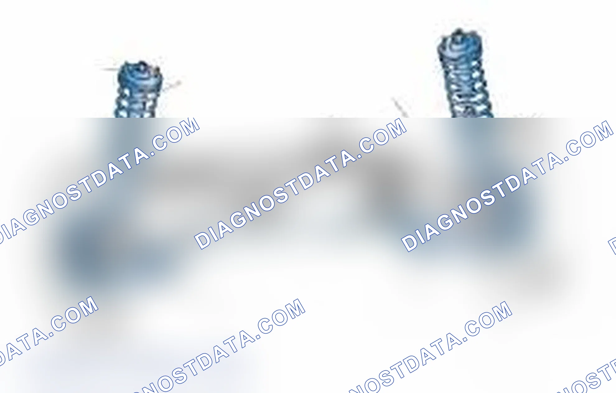 Scheme 25: Typical Front Suspension & Steering Components