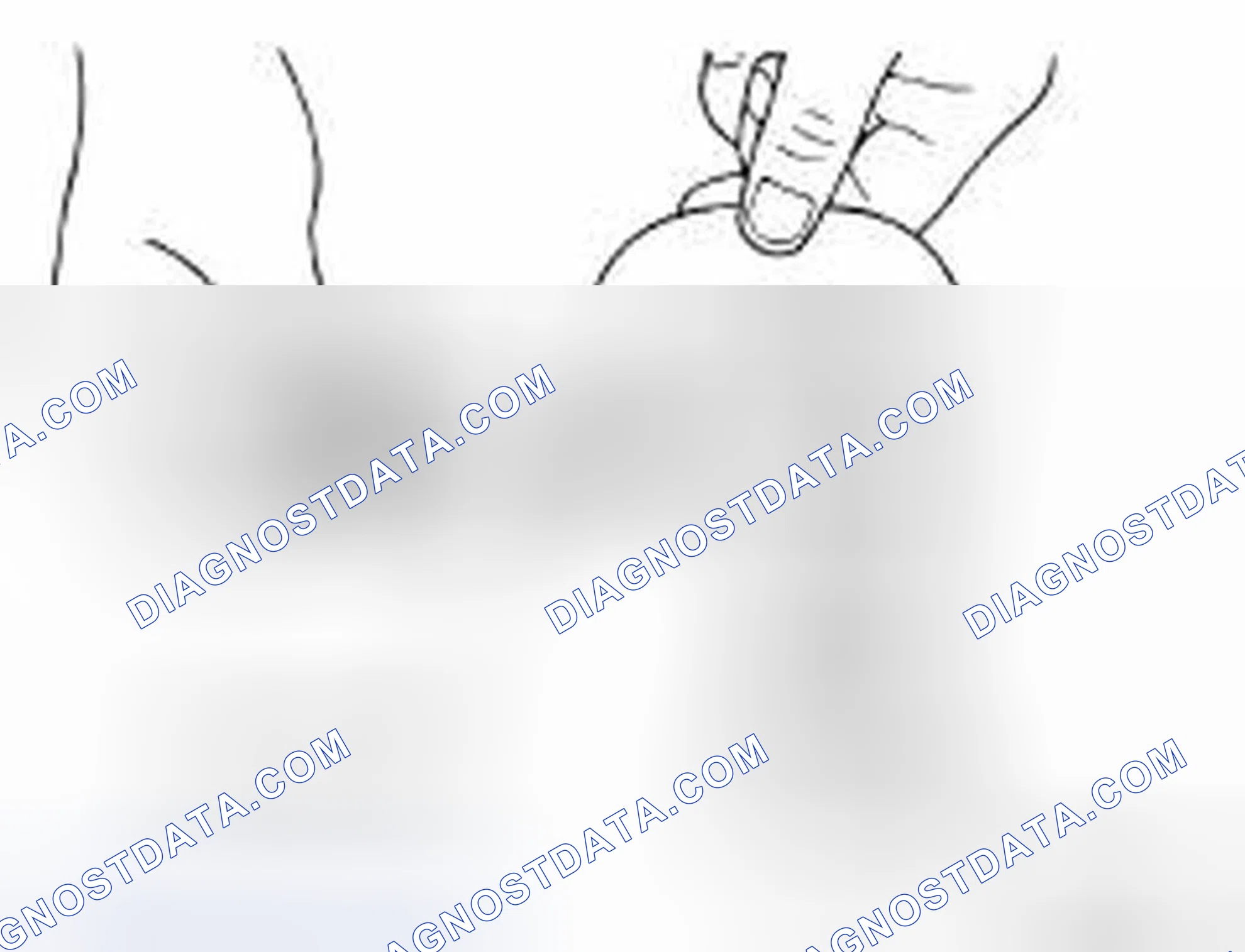 Scheme 162: Camshaft Journal Clearance