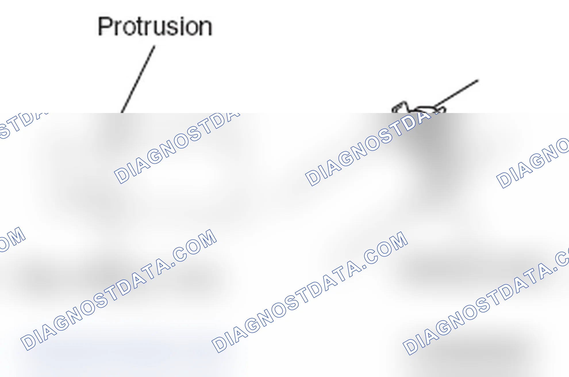 Scheme 315: >> H << RADIATOR LOWER HOSE/RADIATOR UPPER HOSE CONNECTION