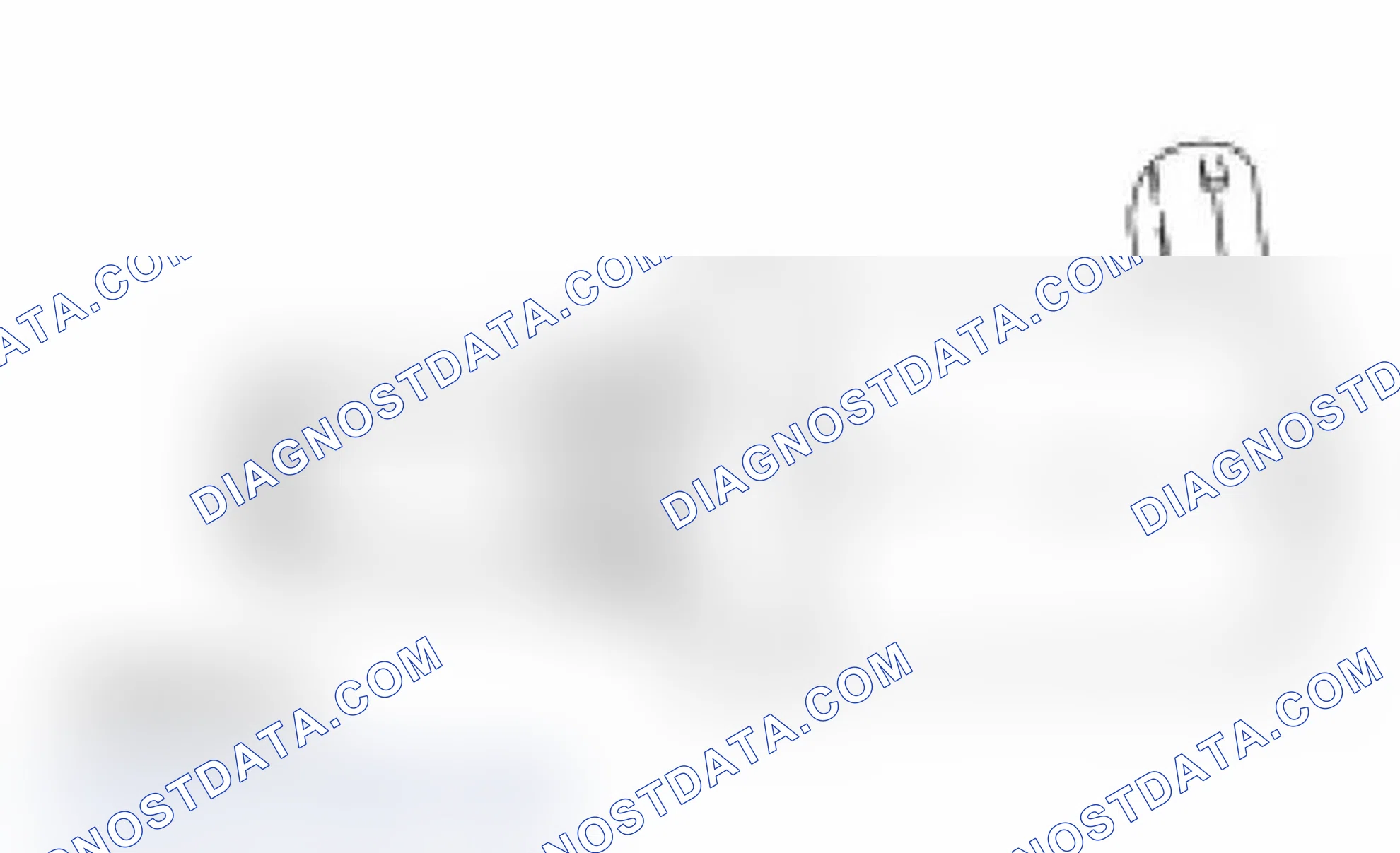 Scheme 158: Injection Pressure Regulator (IPR)