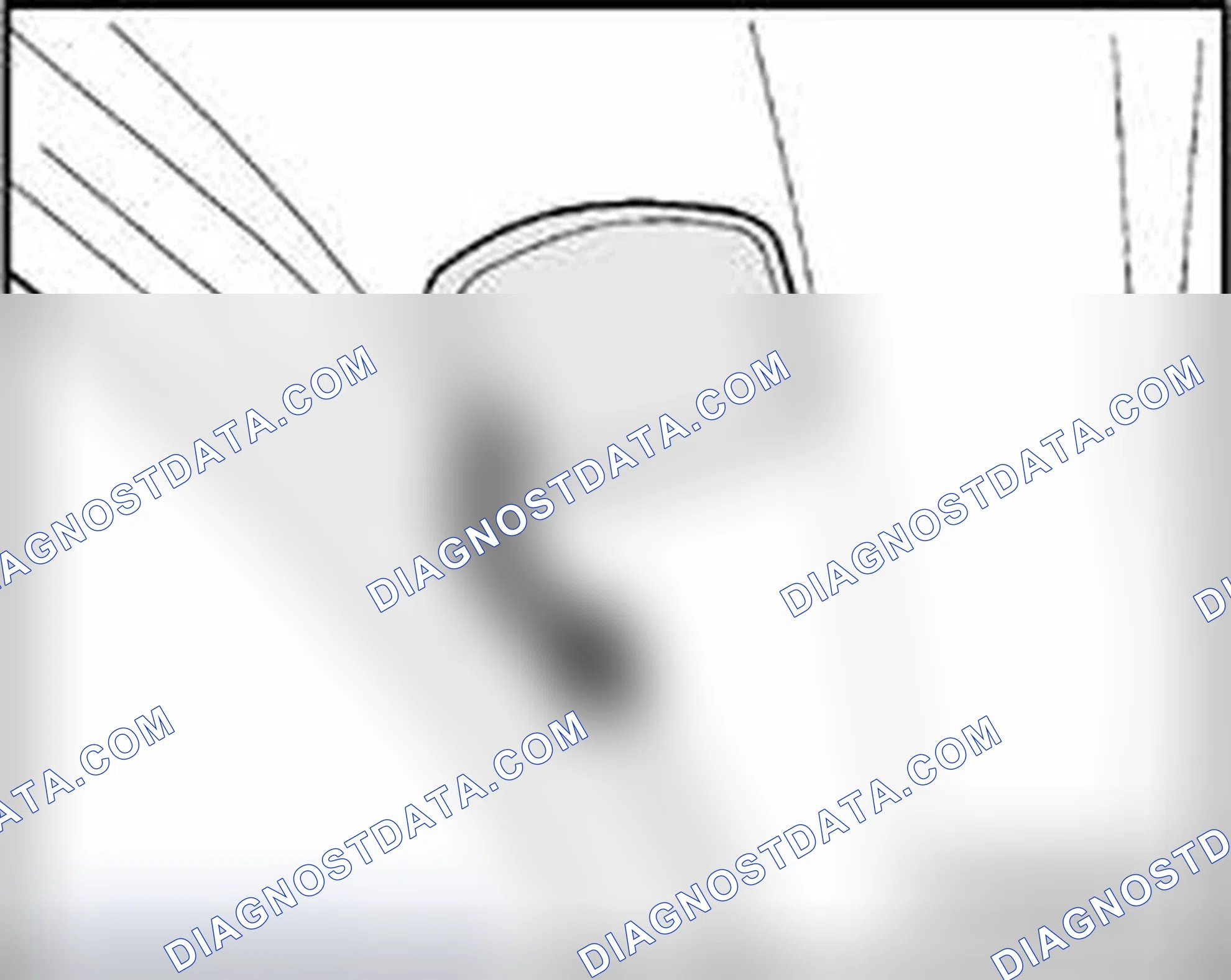 Scheme 140: Washer nozzles, removing and installing