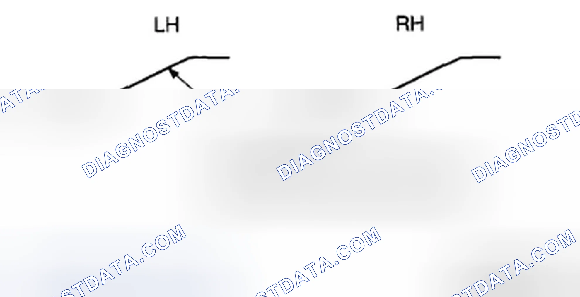 Scheme 74: HEADLIGHT AIMING