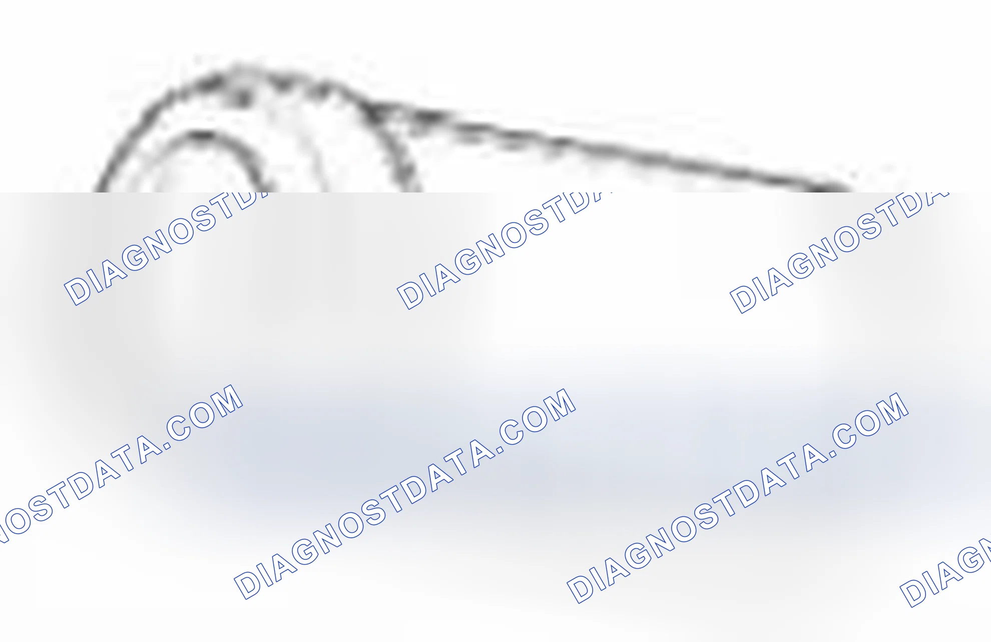 Scheme 14: Special Service Tools