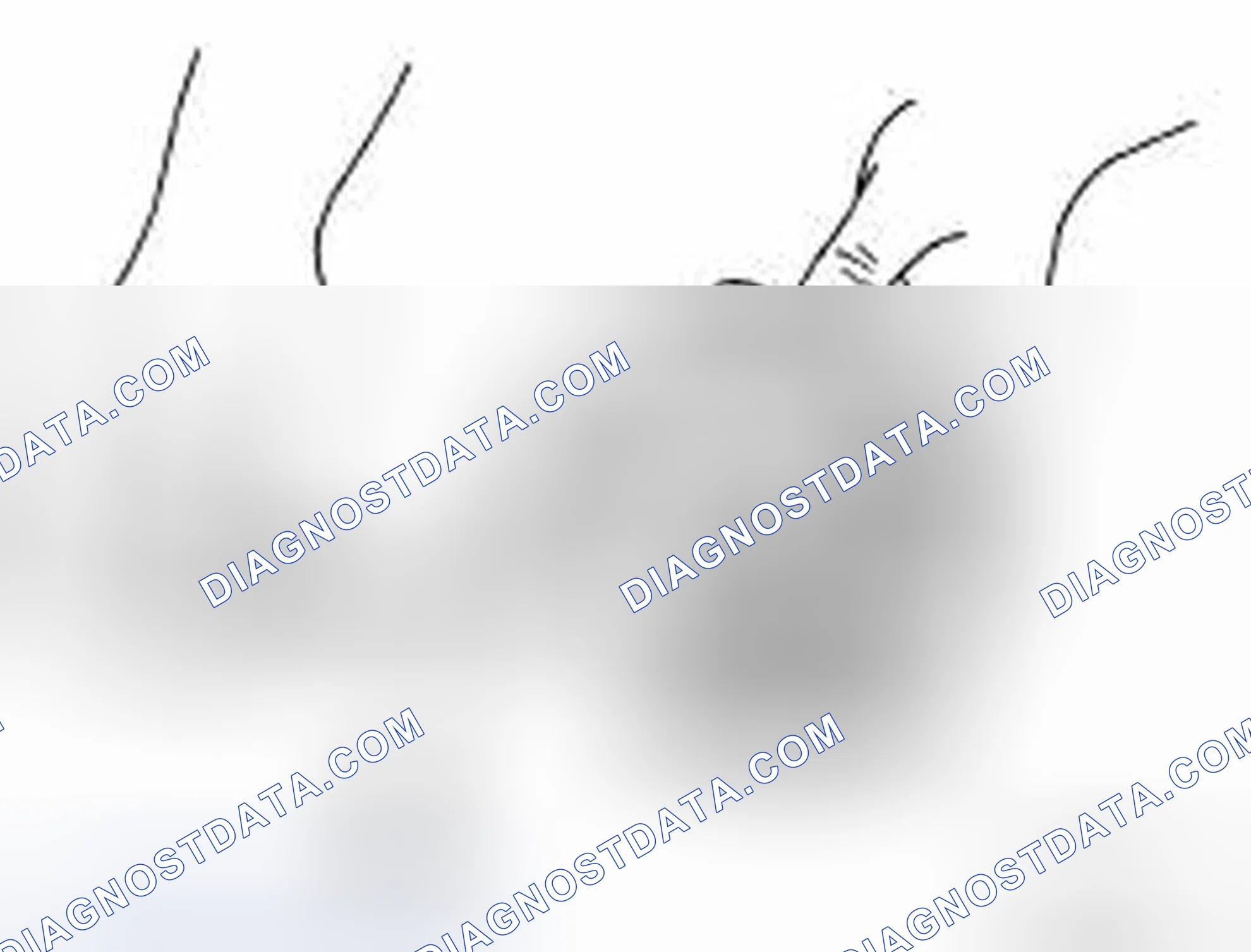 Scheme 197: Piston Skirt Diameter