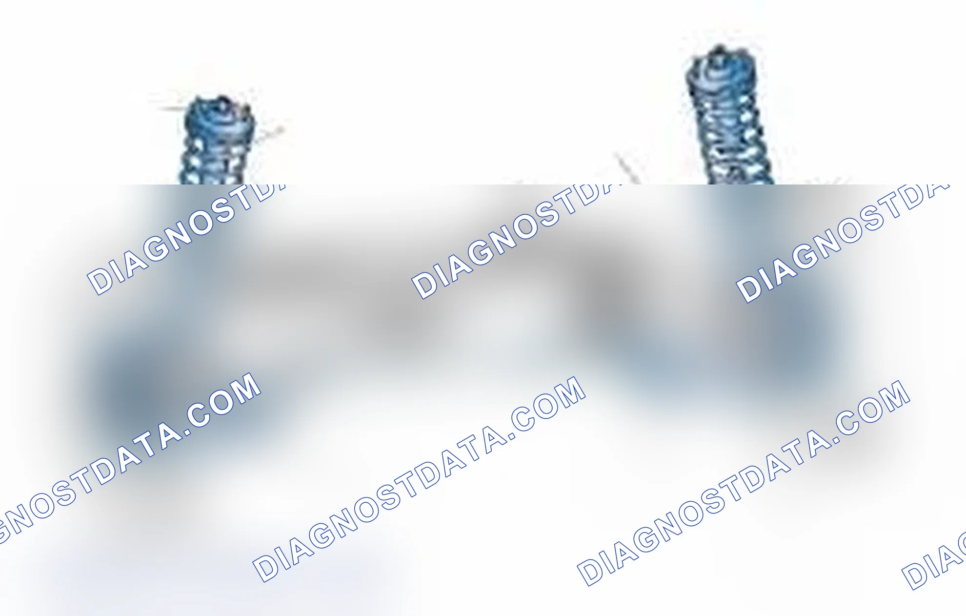 Scheme 25: Typical Front Suspension & Steering Components