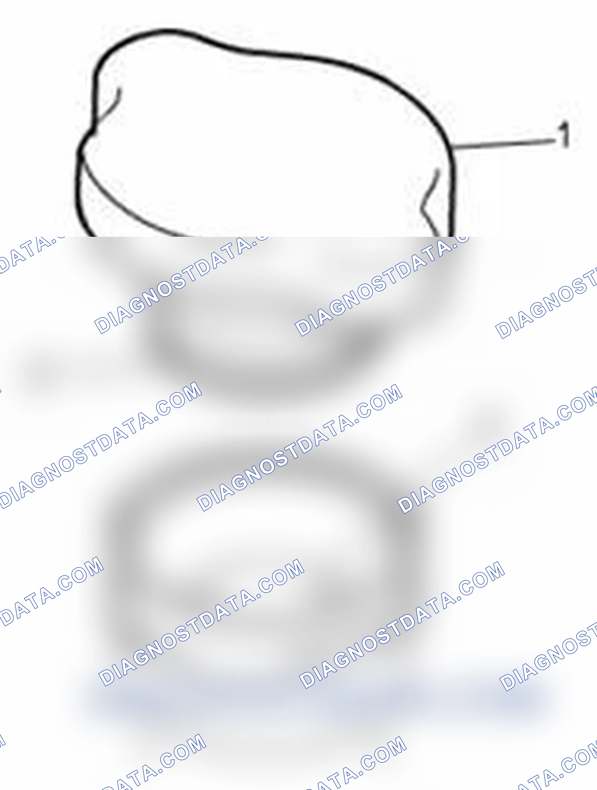Scheme 5: Installation
