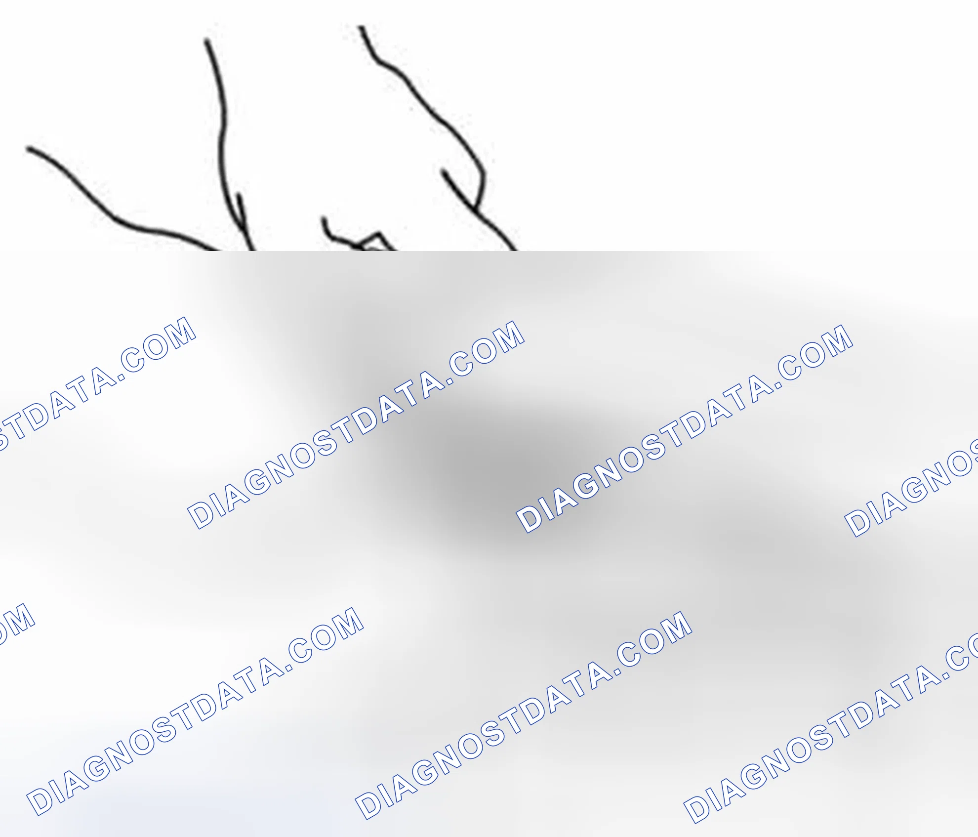 Scheme 223: Distortion of Gasket Surface