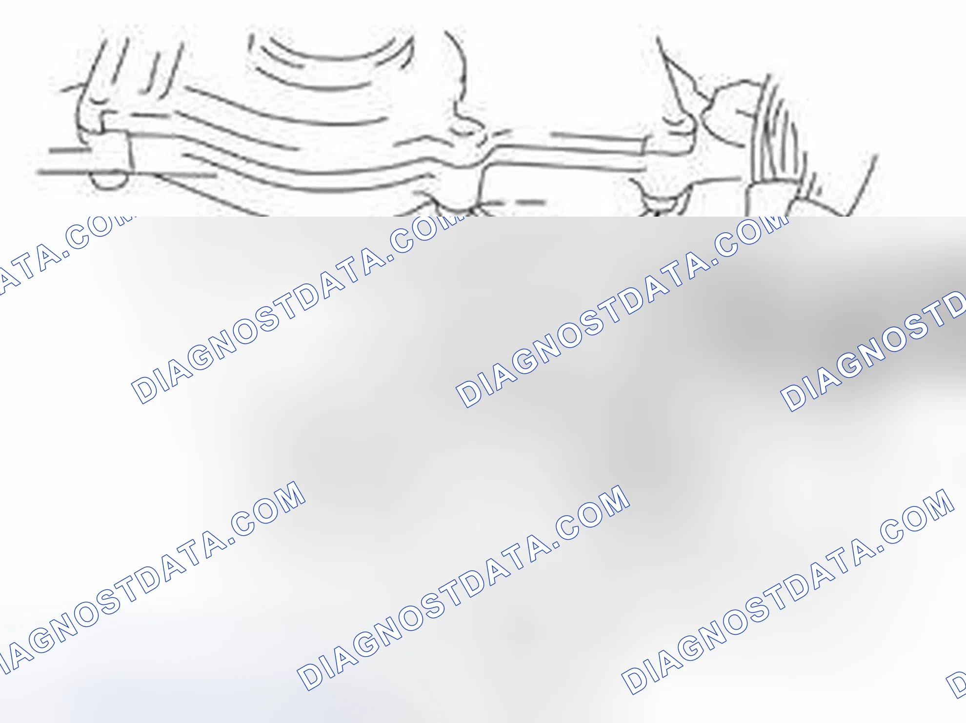 Scheme 1376: Removing the Cable Harness
