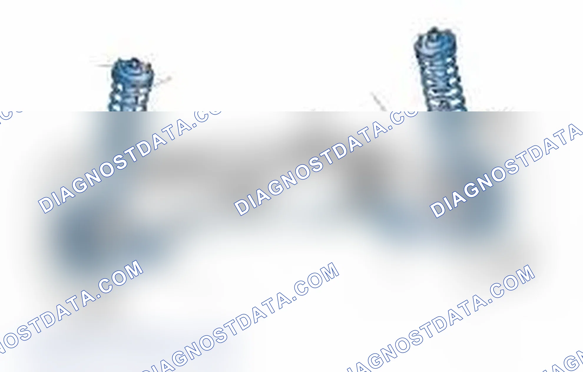 Scheme 25: Typical Front Suspension & Steering Components