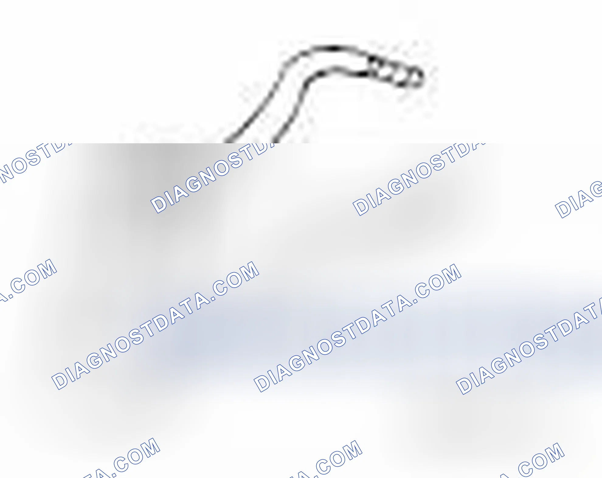 Scheme 17: SPECIAL TOOLS