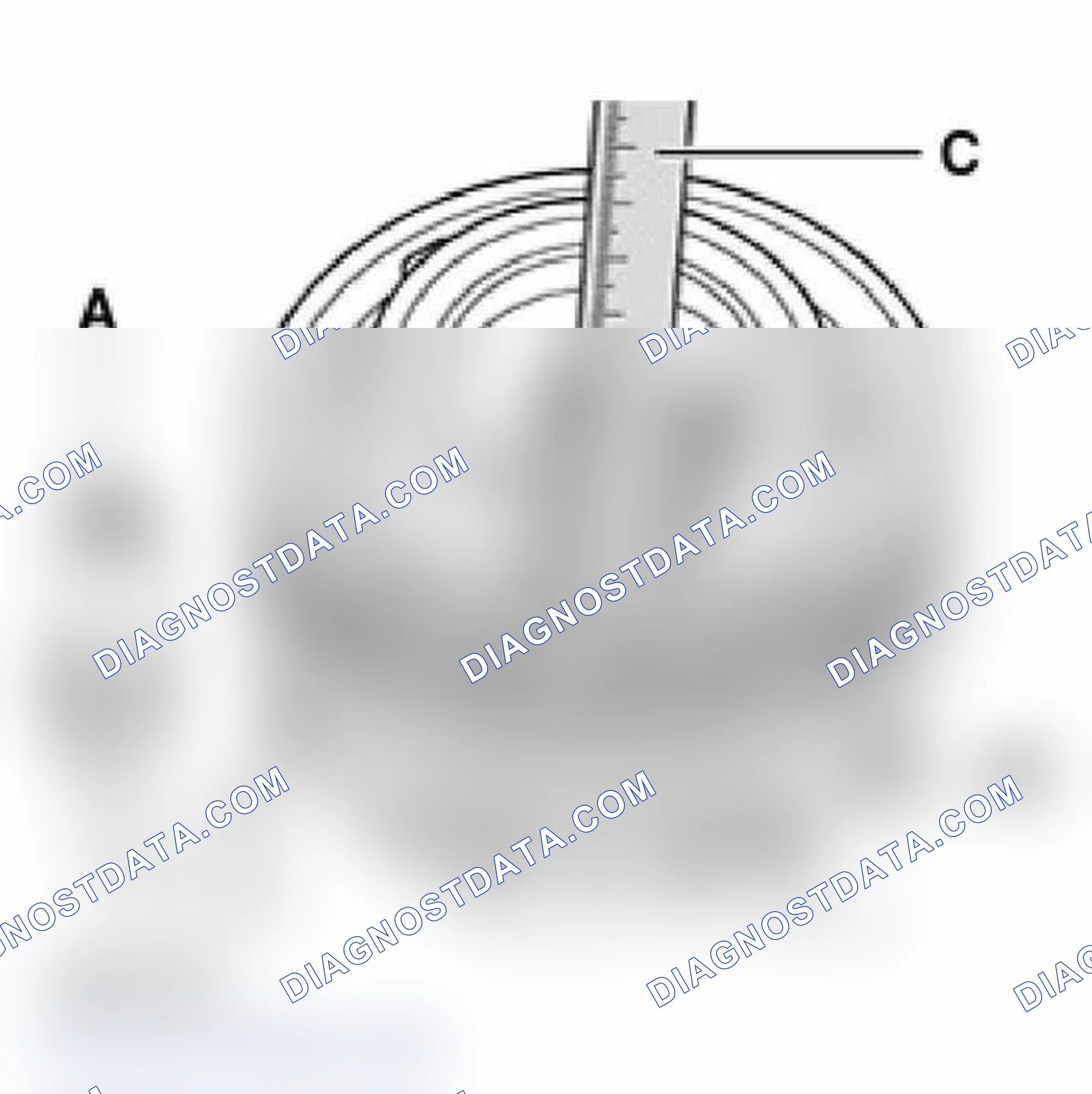 Scheme 18: Checking and adjusting gap