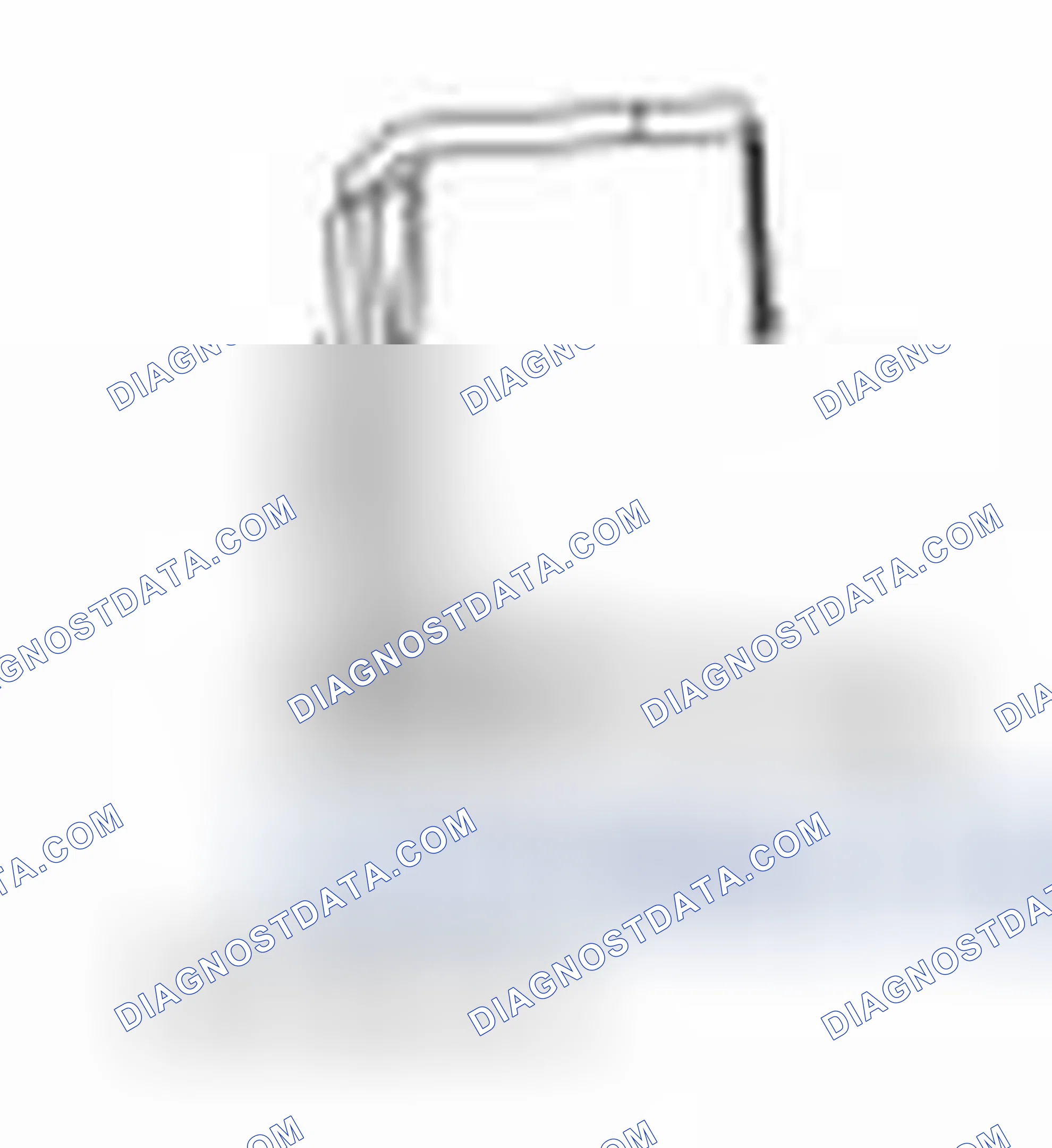 Scheme 148: Special Tool(s)