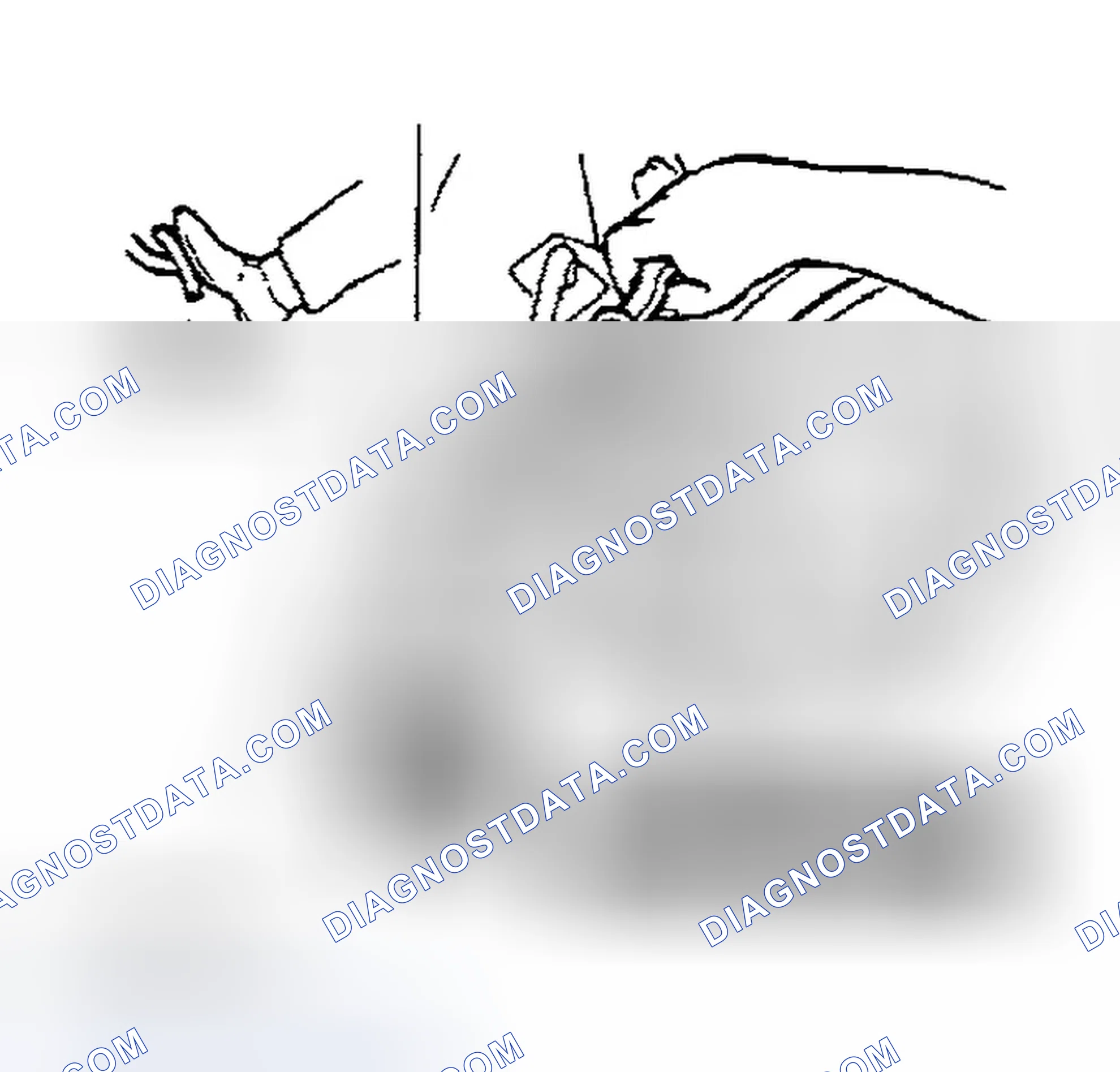 Scheme 42: AIR BLEEDING
