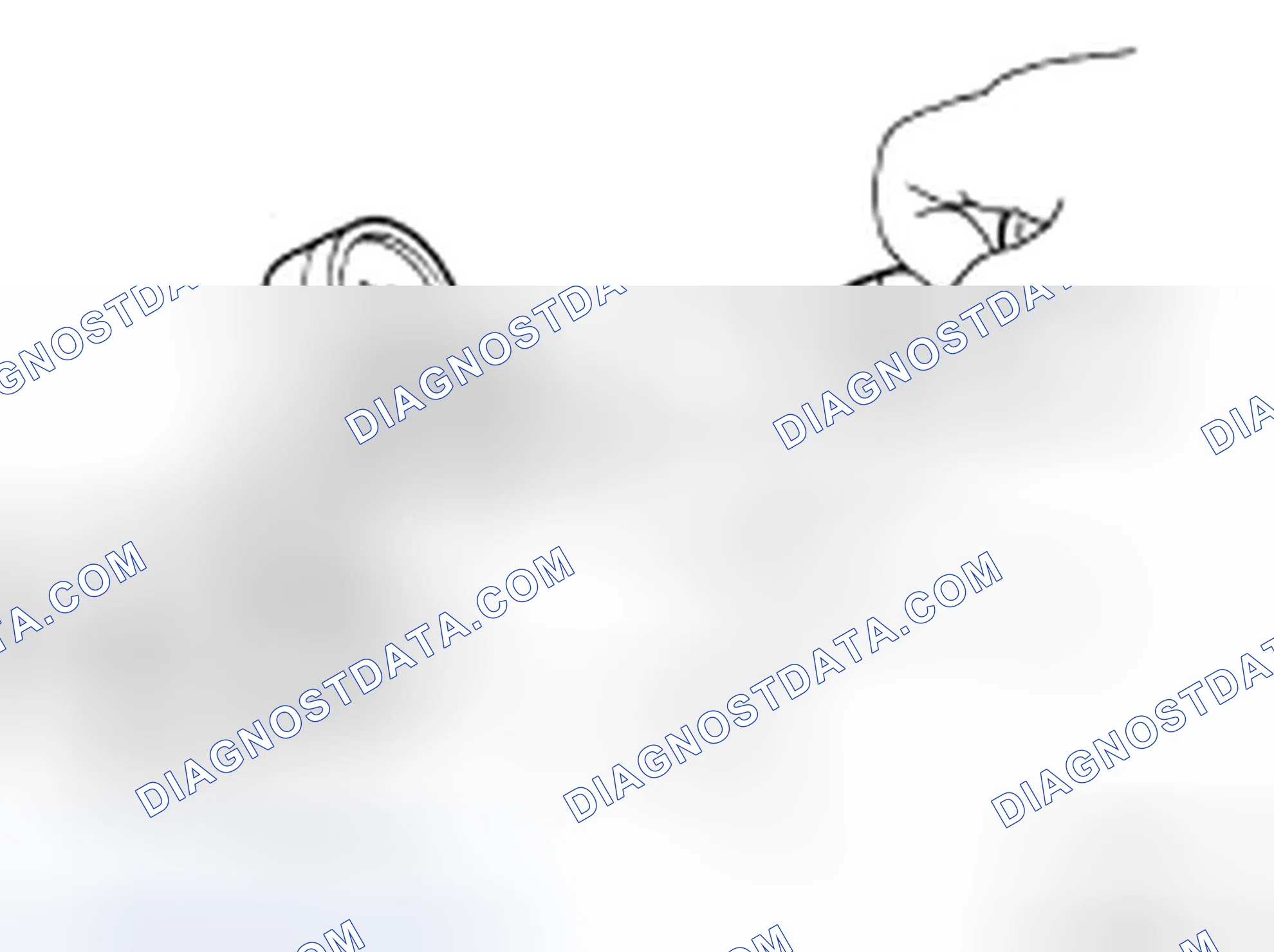 Scheme 37: CHECKING RESERVOIR CAP