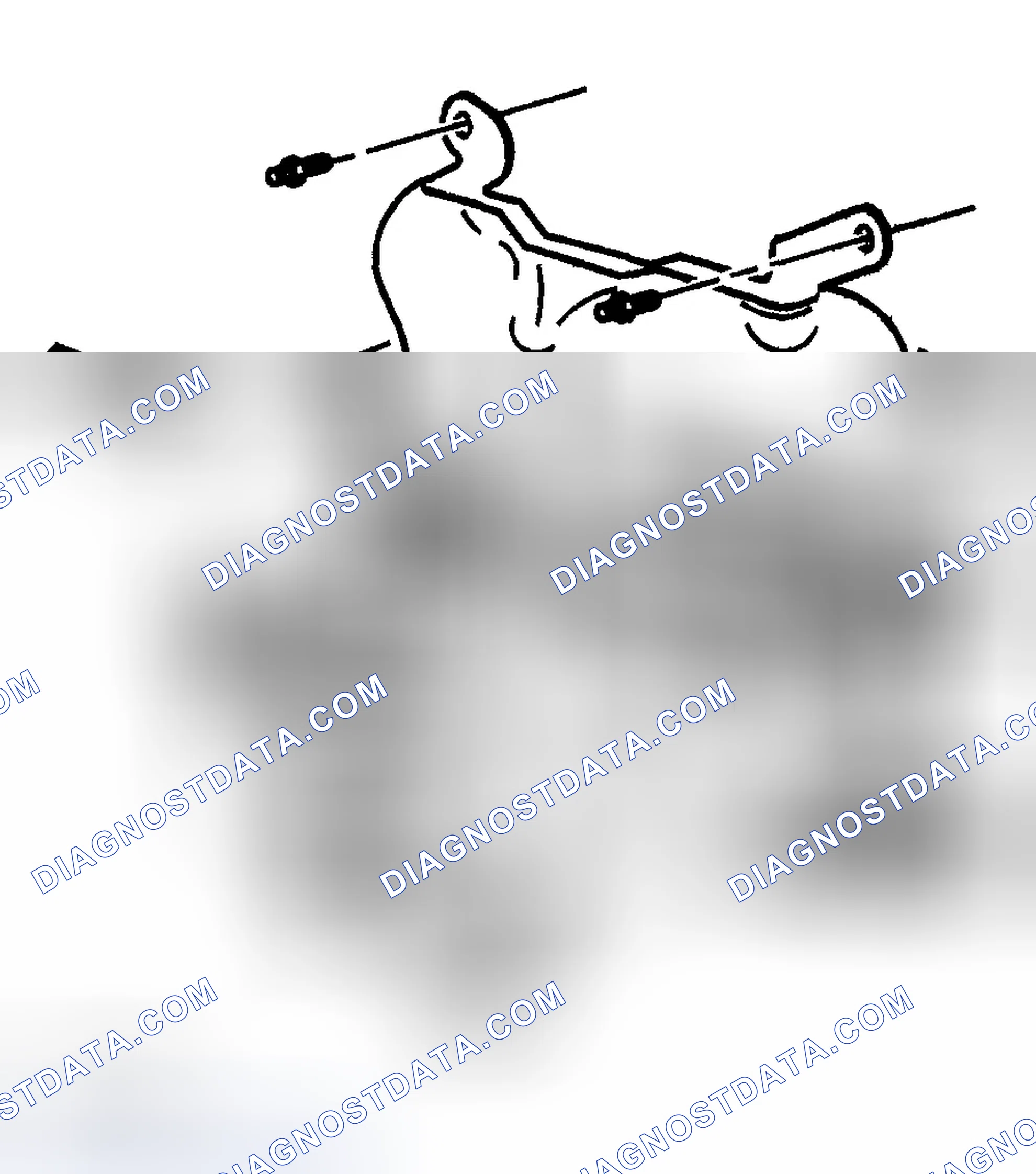 Scheme 5: Removal Procedure