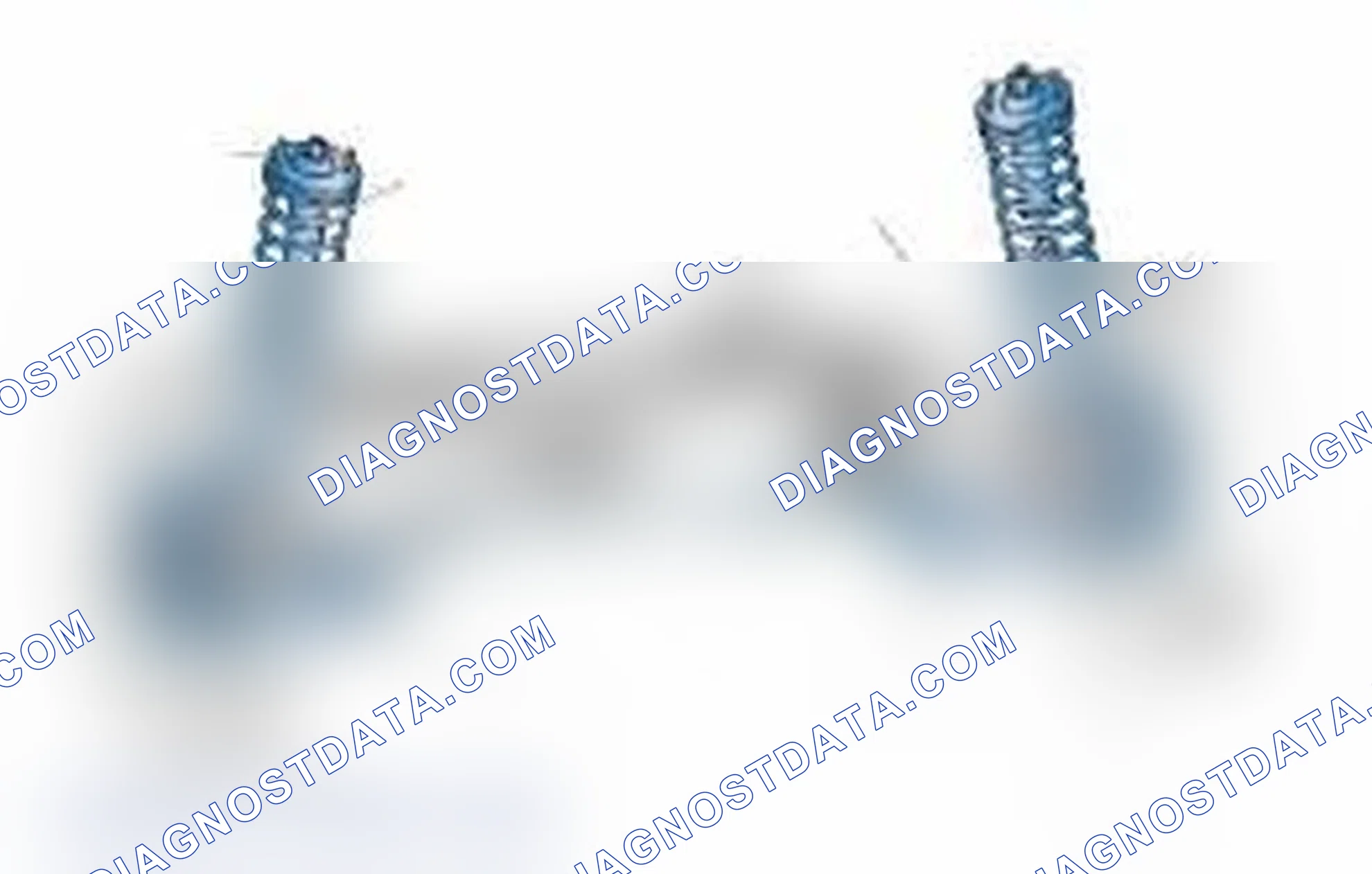 Scheme 25: Typical Front Suspension & Steering Components