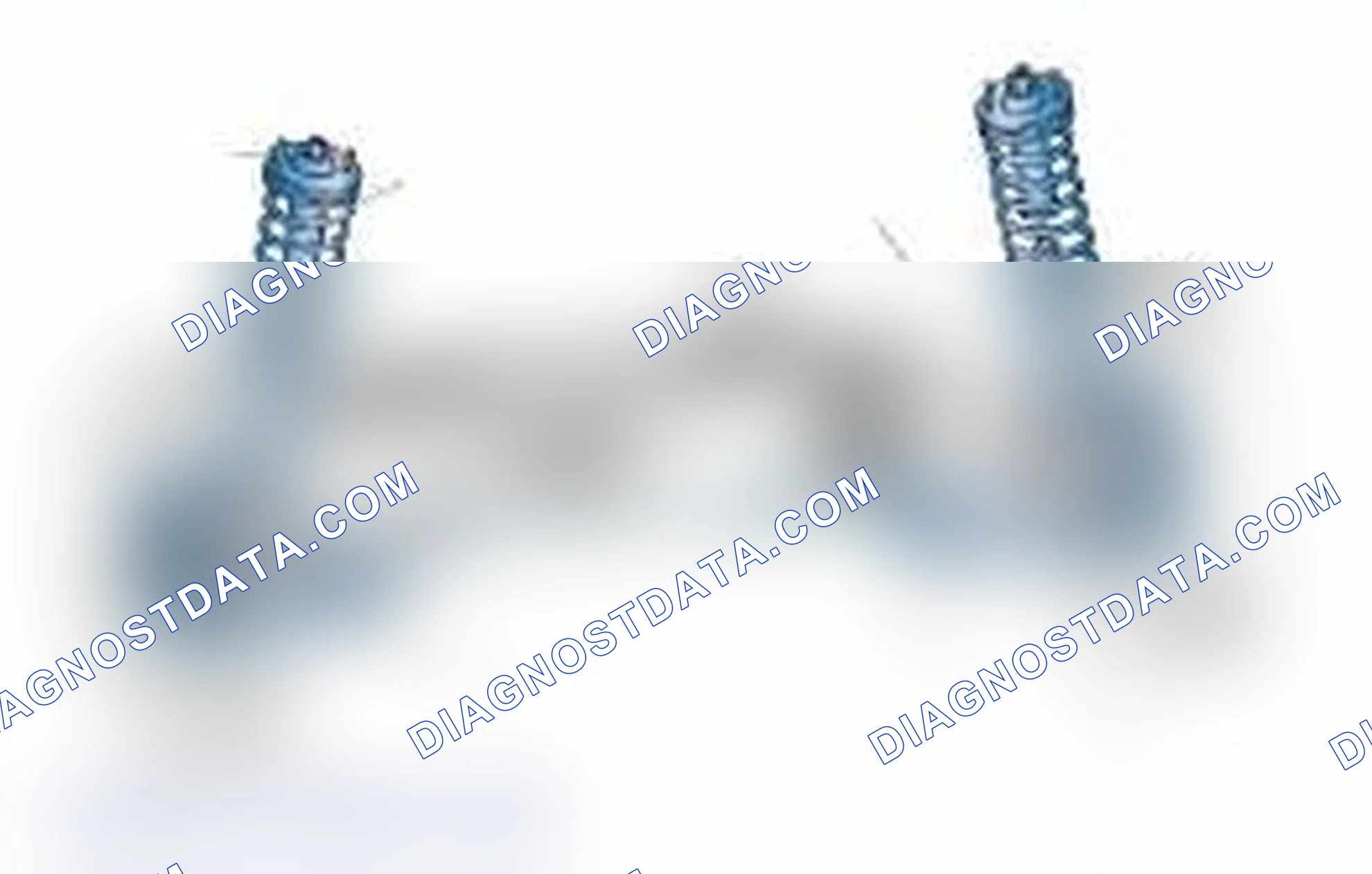 Scheme 25: Typical Front Suspension & Steering Components
