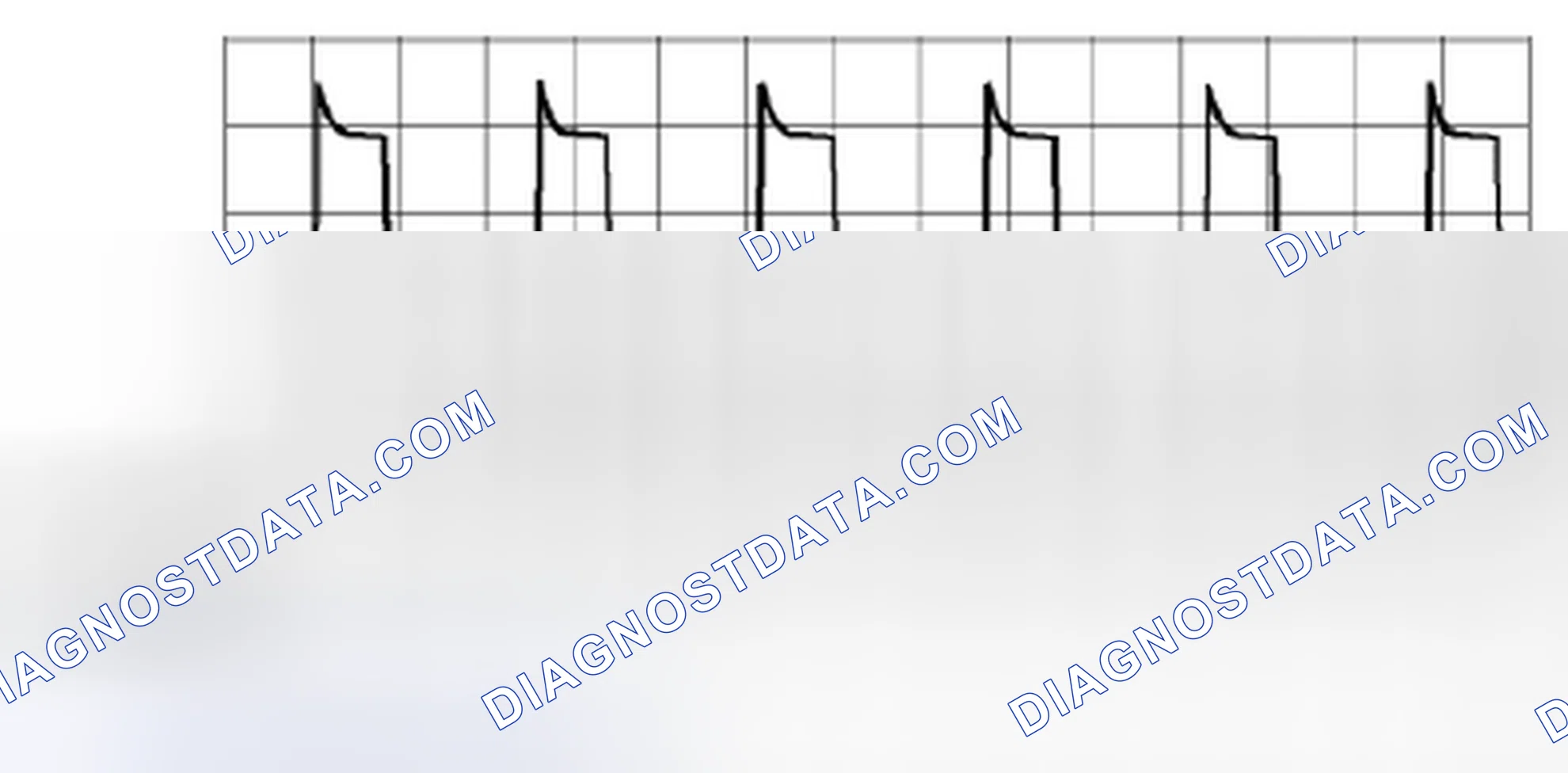 Scheme 59: Generated Pulse - Pattern 3