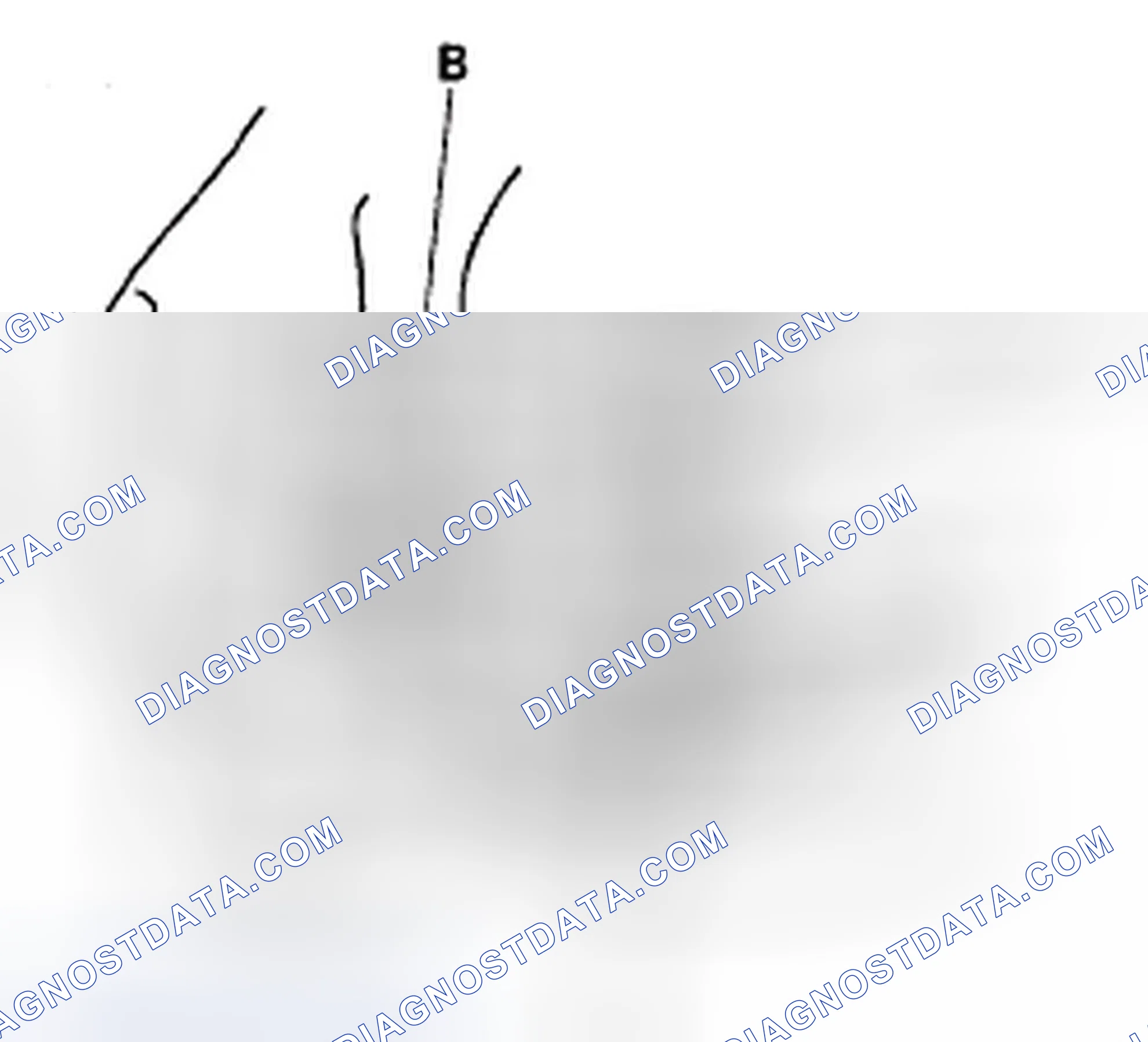 Scheme 3: Overrunning Clutch Inspection