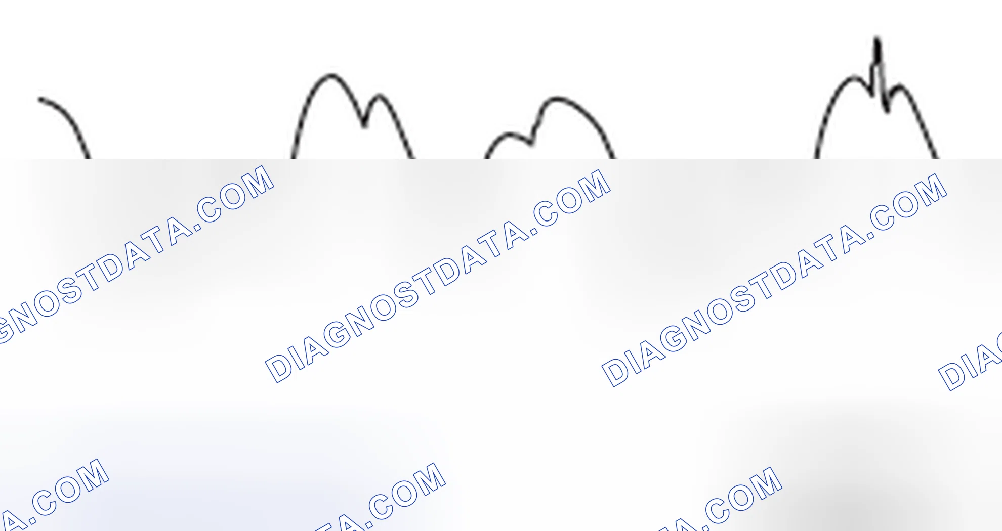 Scheme 32: ABNORMAL WAVEFORMS