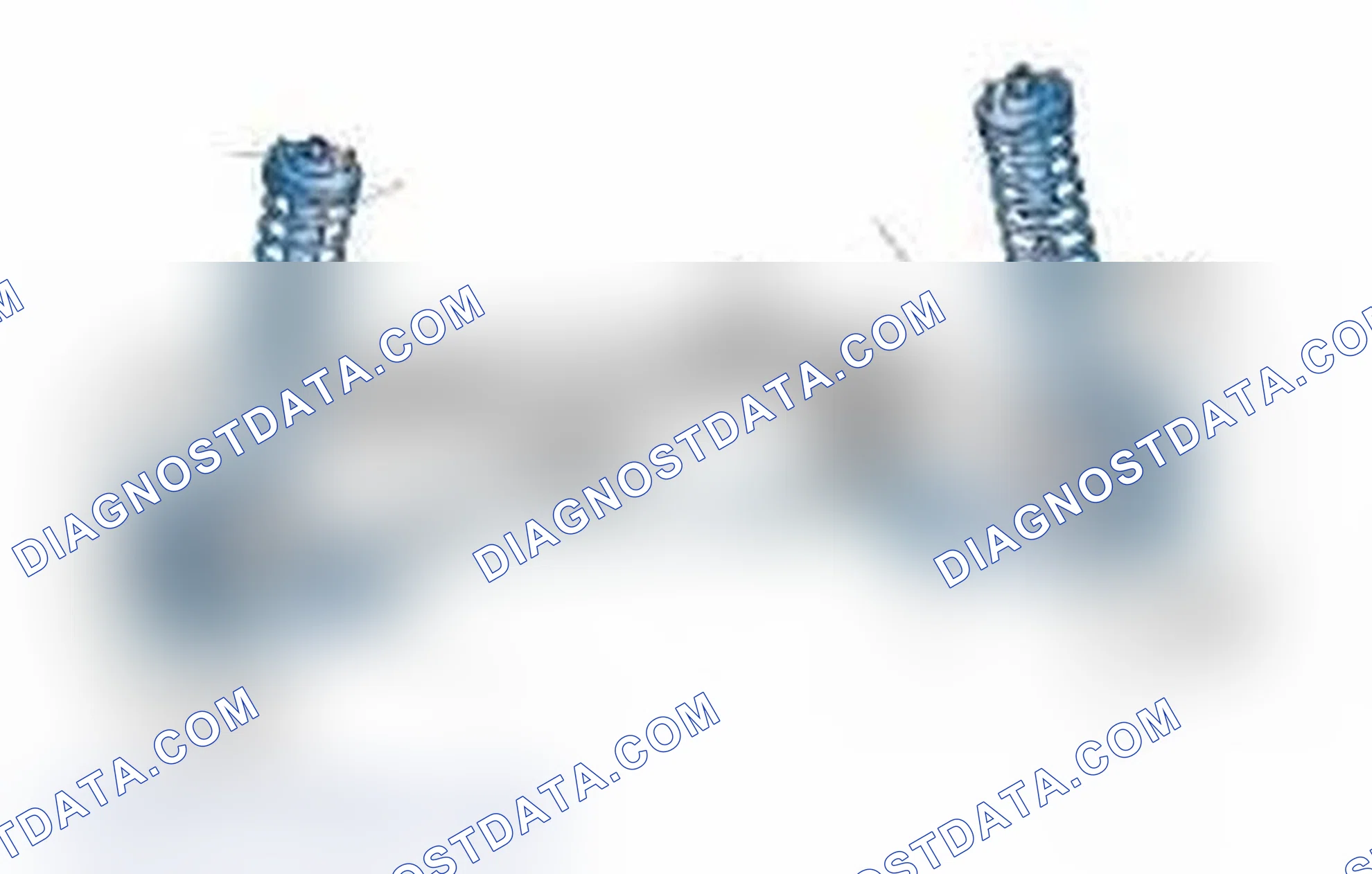 Scheme 25: Typical Front Suspension & Steering Components