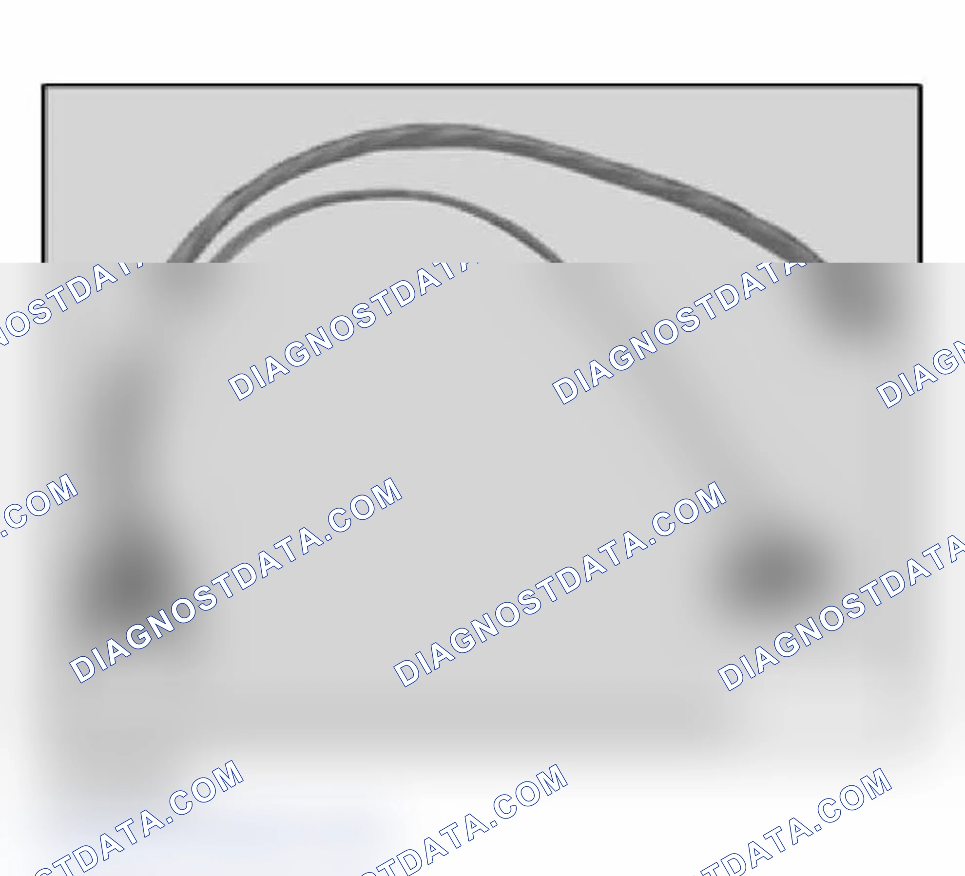 Scheme 11: 61 3 090 V-adapter lead DXC control unit E83 (6-pin)