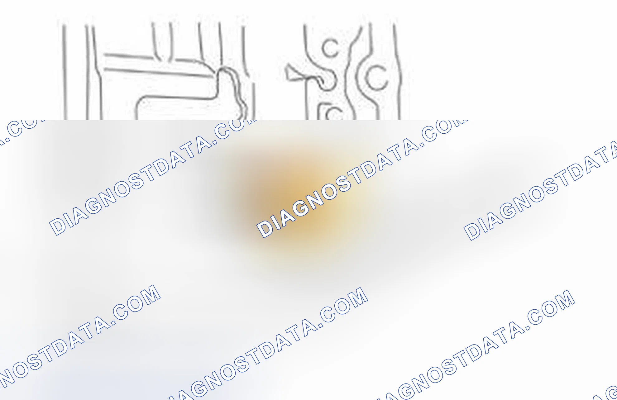 Scheme 1488: TRANSMISSION INPUT SPEED SENSOR, INPUT SHAFT, TRANSAXLE (TSS)