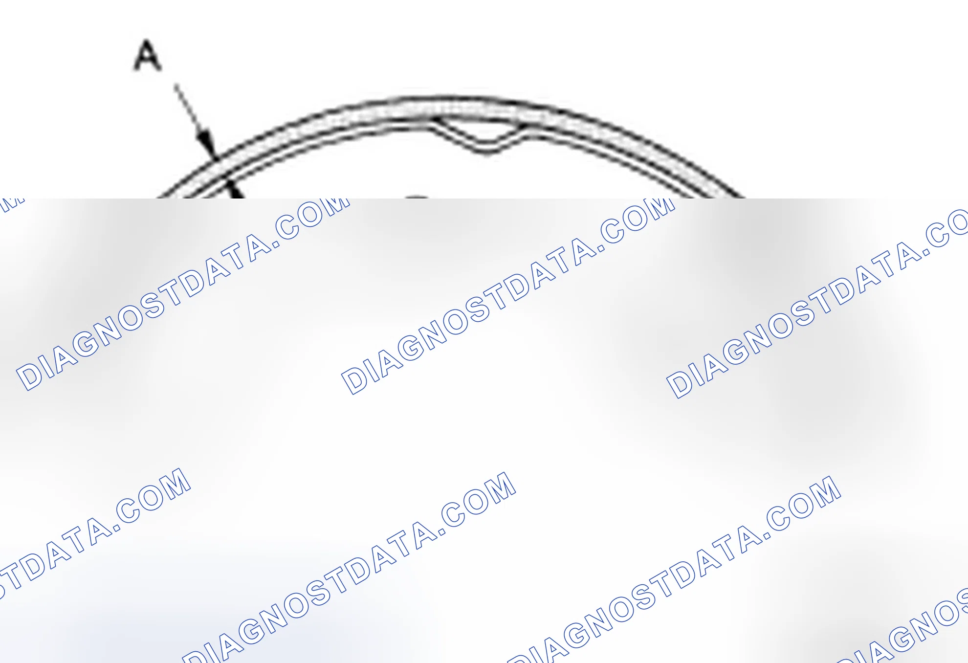 Scheme 59: LINING