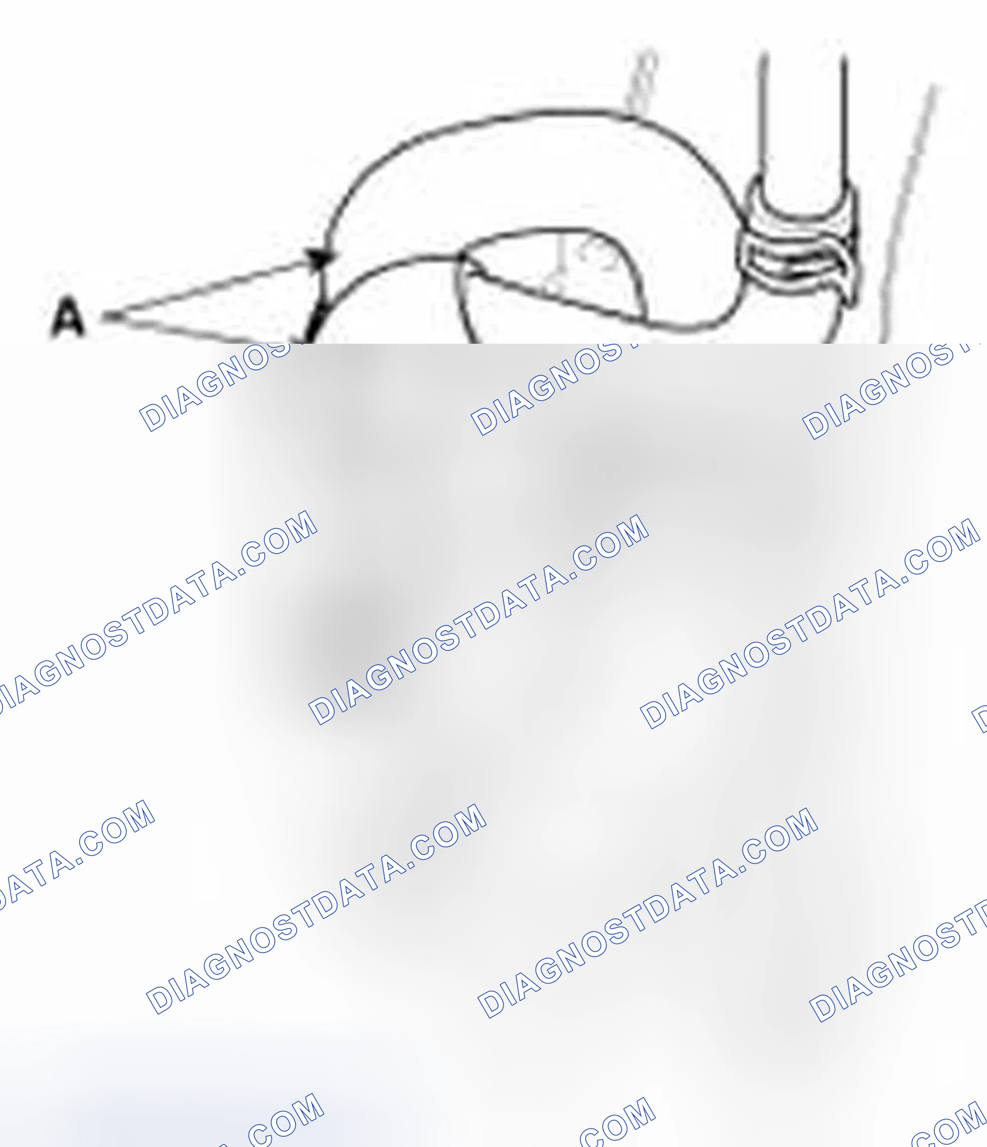 Scheme 456: Auxiliary Canister