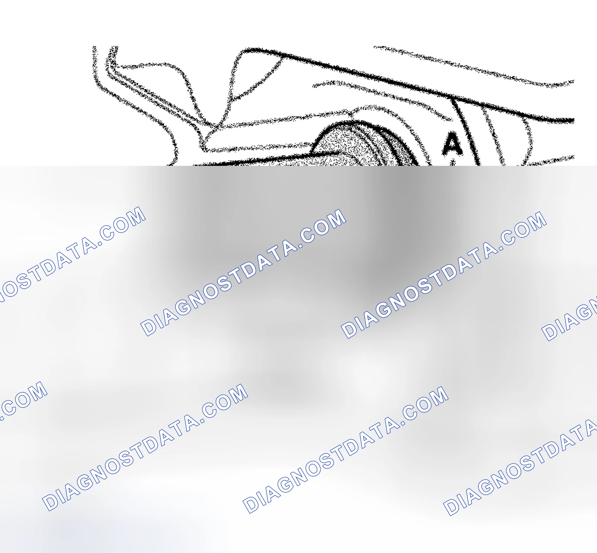 Scheme 65: Removal & Installation