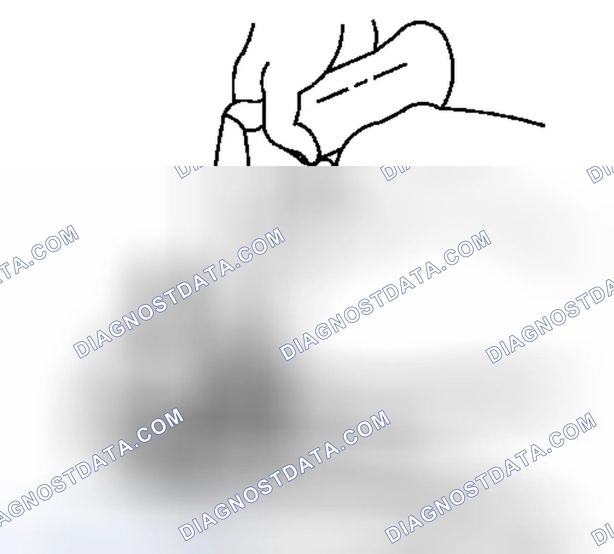 Scheme 12: Removal Procedure