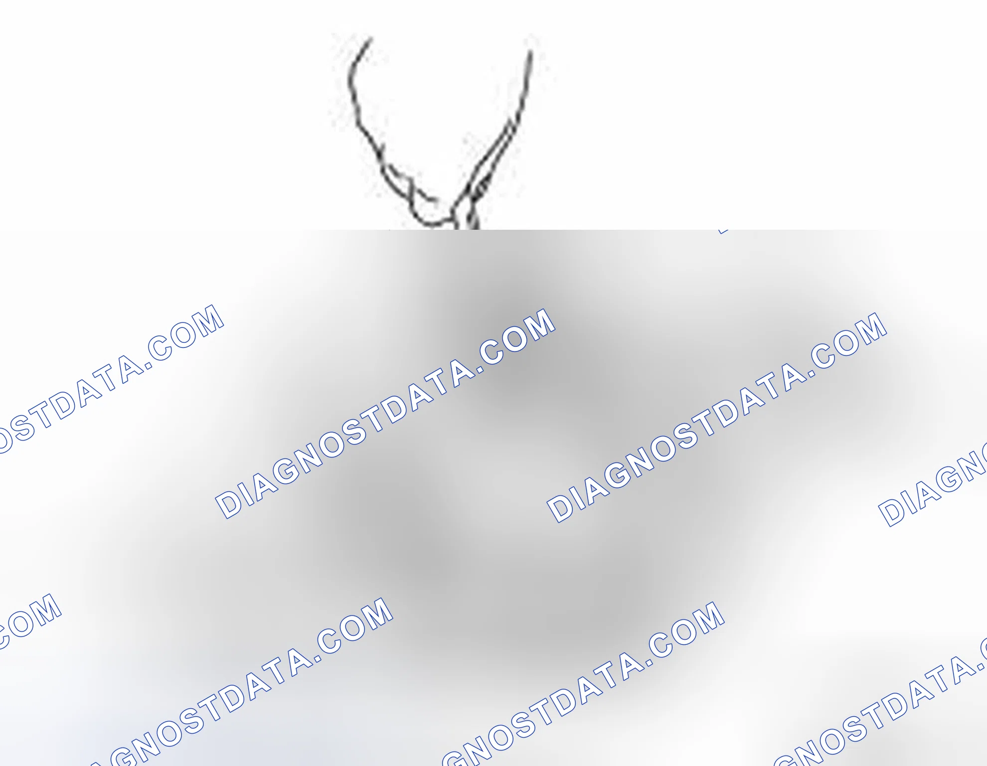 Scheme 284: Tooth Contact
