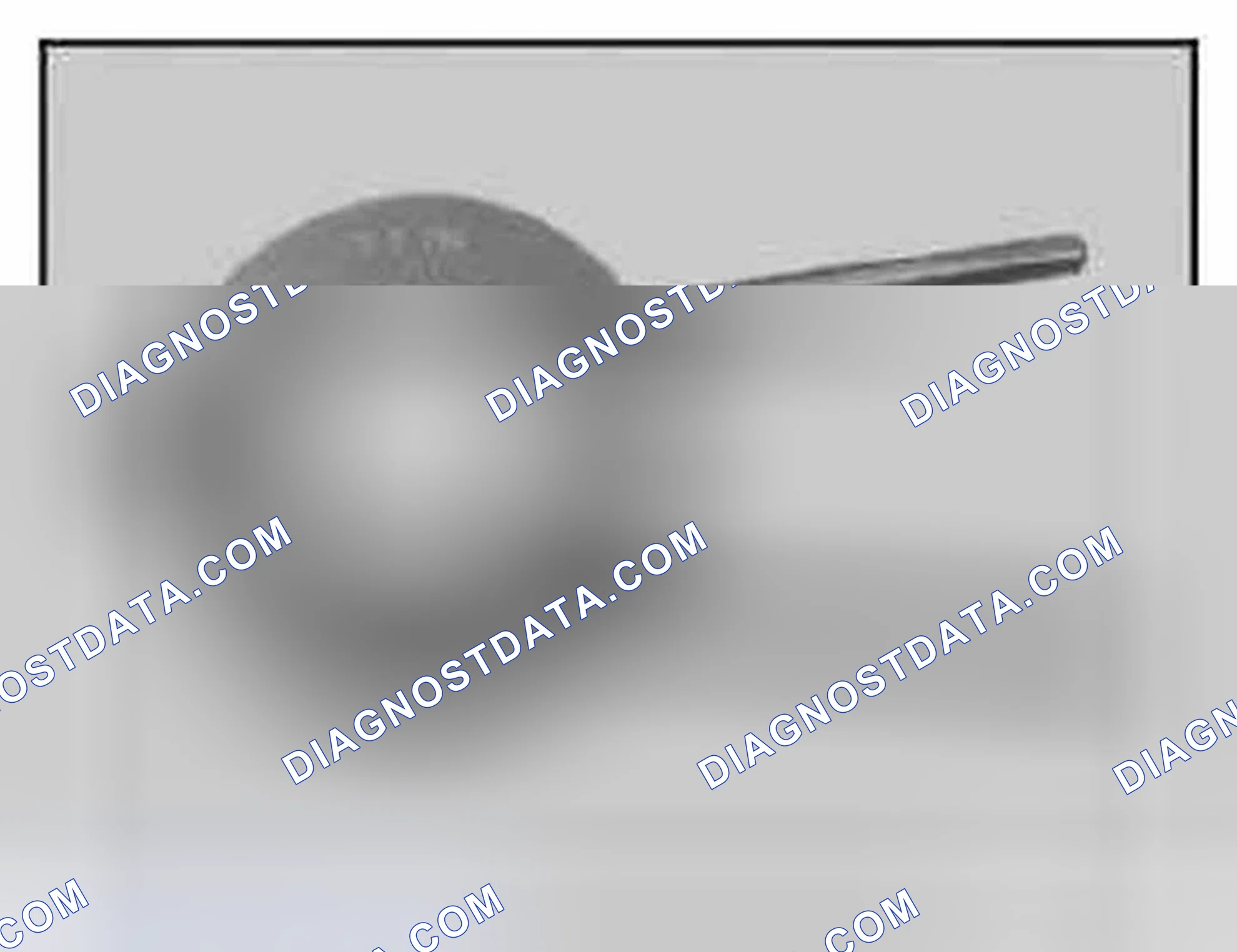 Scheme 408: 11 7 280 Piston ring pliers