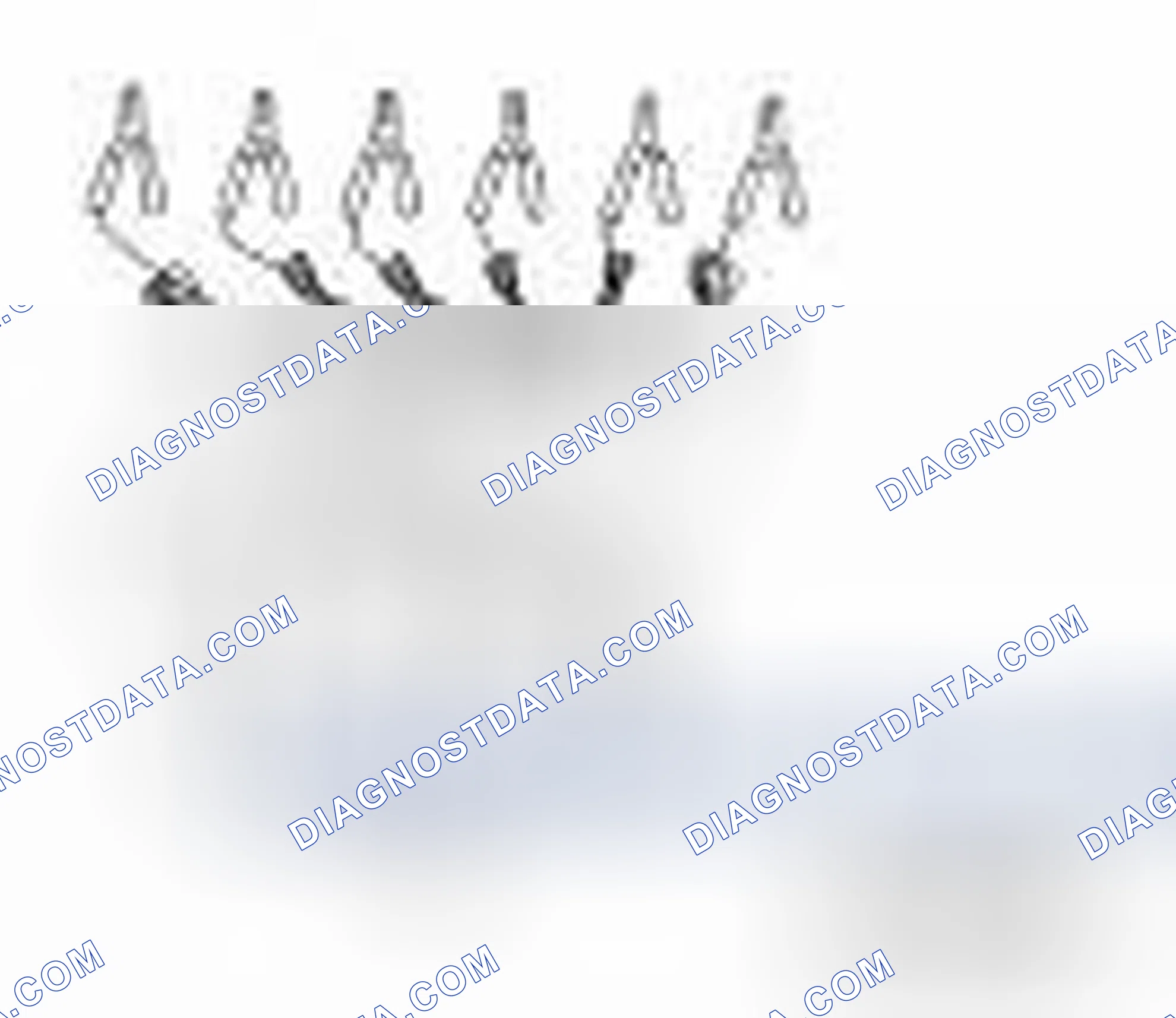 Scheme 134: Special Service Tool