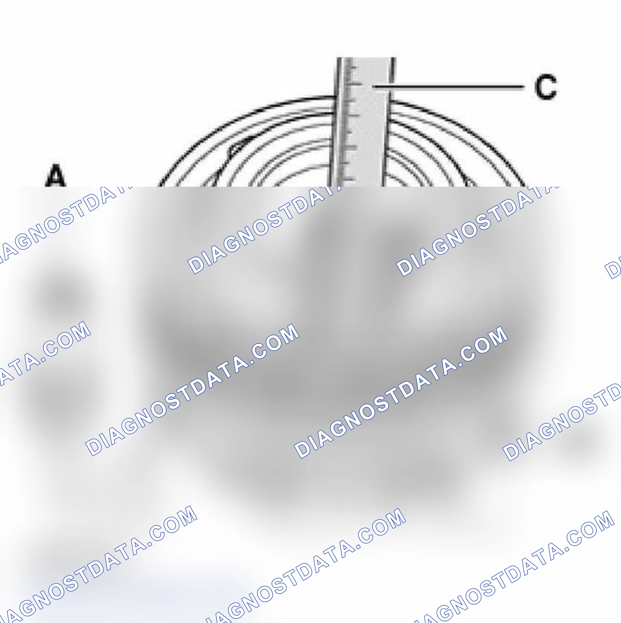 Scheme 18: Checking and adjusting gap