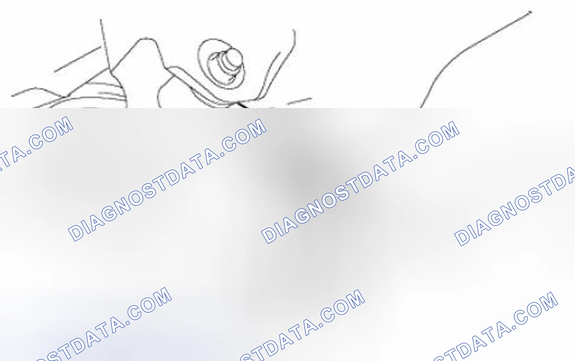 Scheme 3: Total Toe-in Adjustment