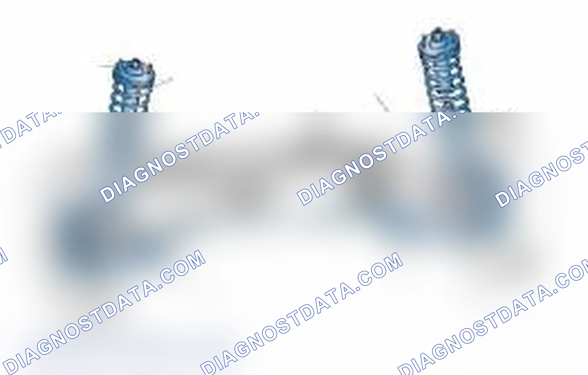 Scheme 25: Typical Front Suspension & Steering Components