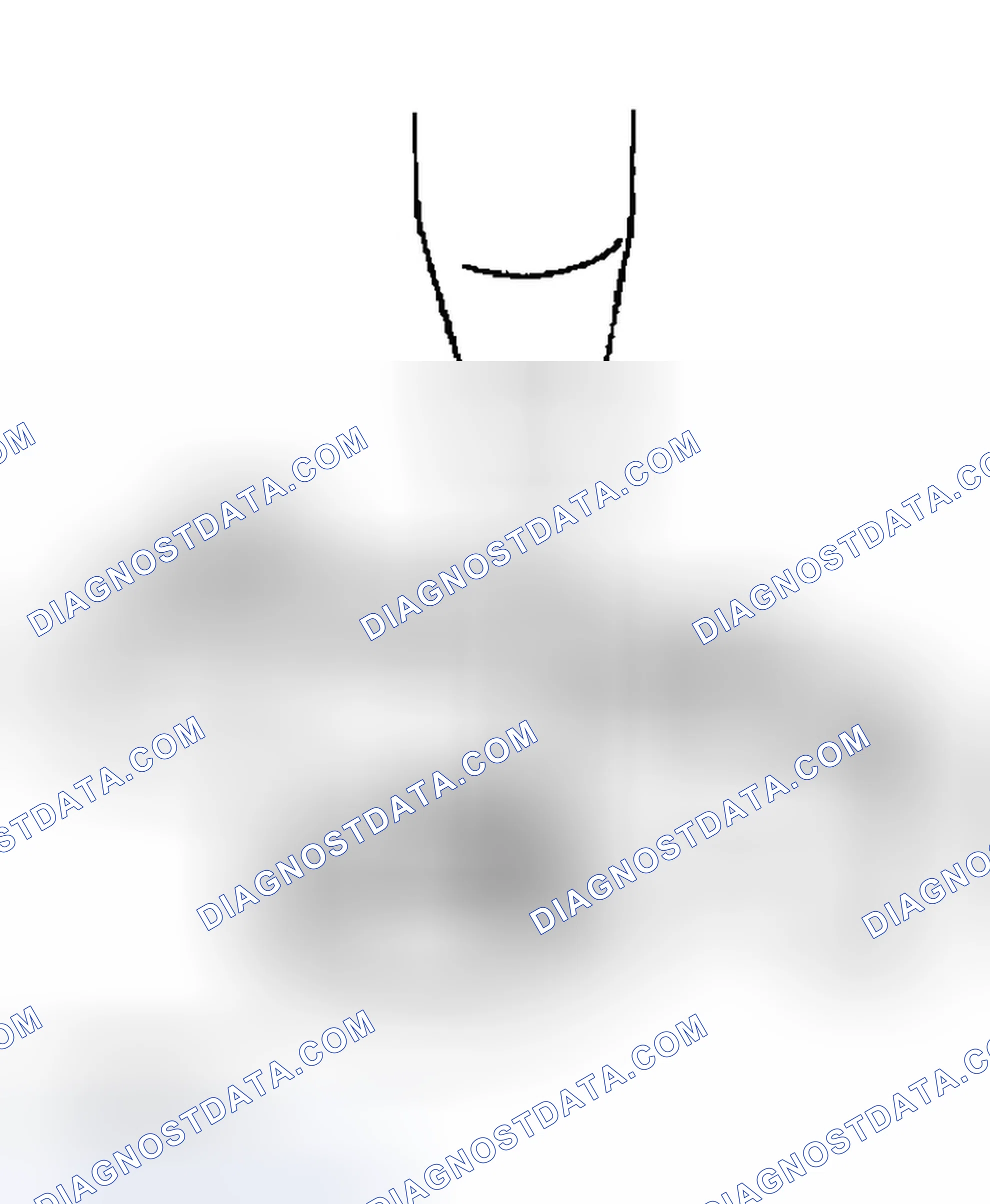 Scheme 121: CAMSHAFT OIL SEAL HOUSING DISASSEMBLY NOTE