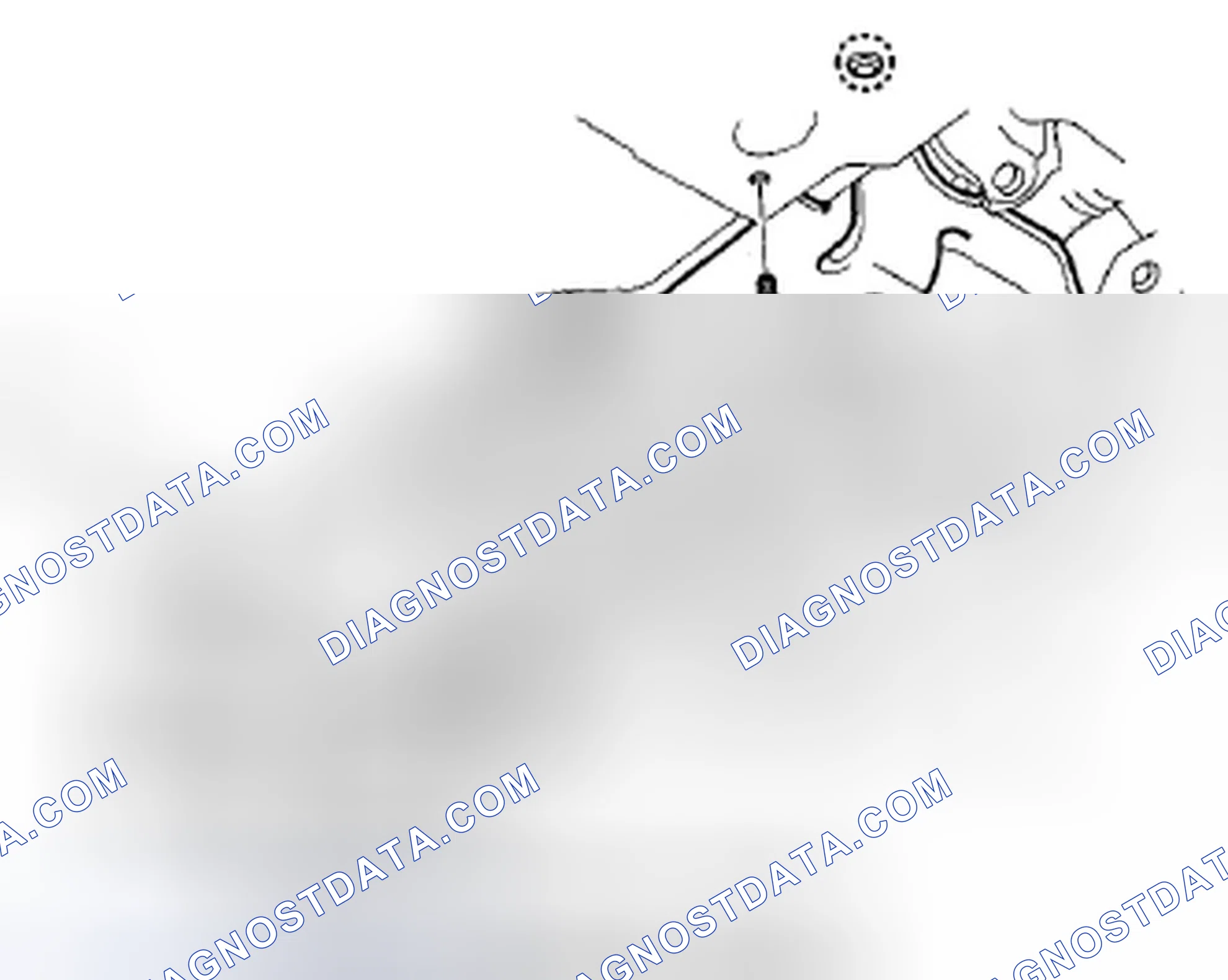 Scheme 38: Stabilizer Bar Replacement