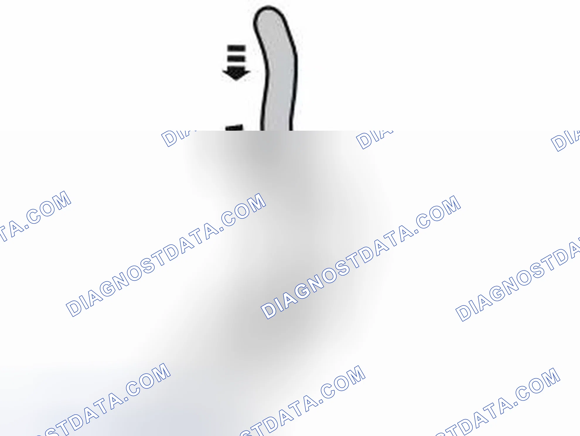 Scheme 33: INSTALL BRACKET