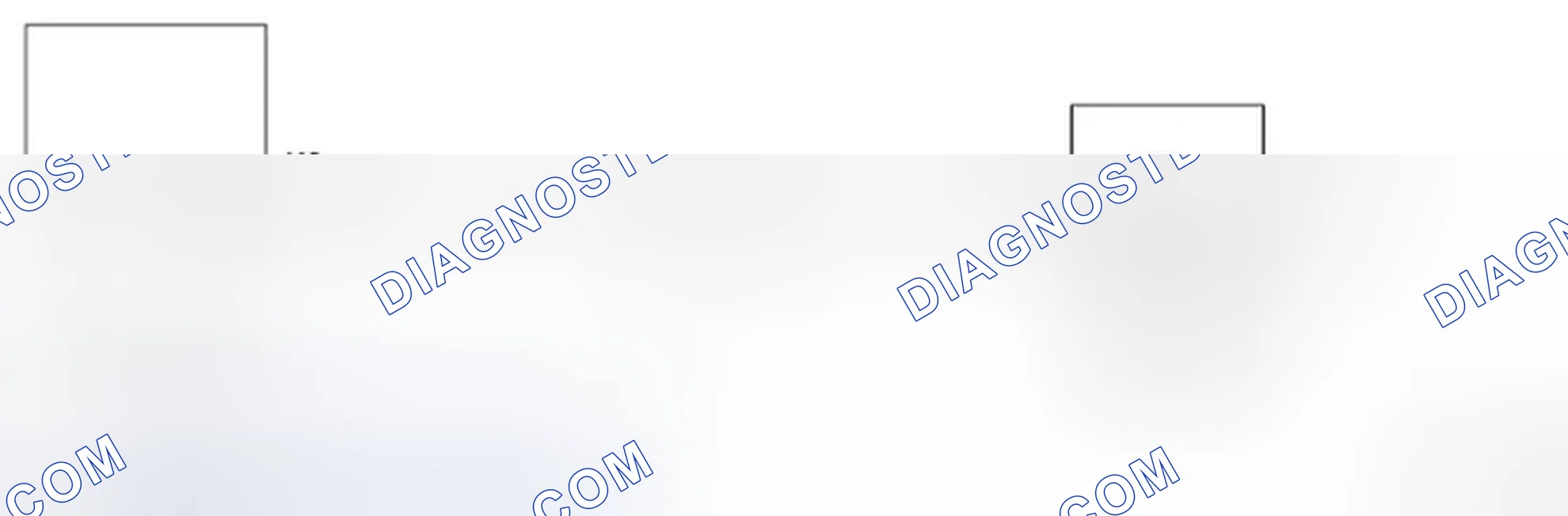 Scheme 291: Knock Sensor Circuit Diagram