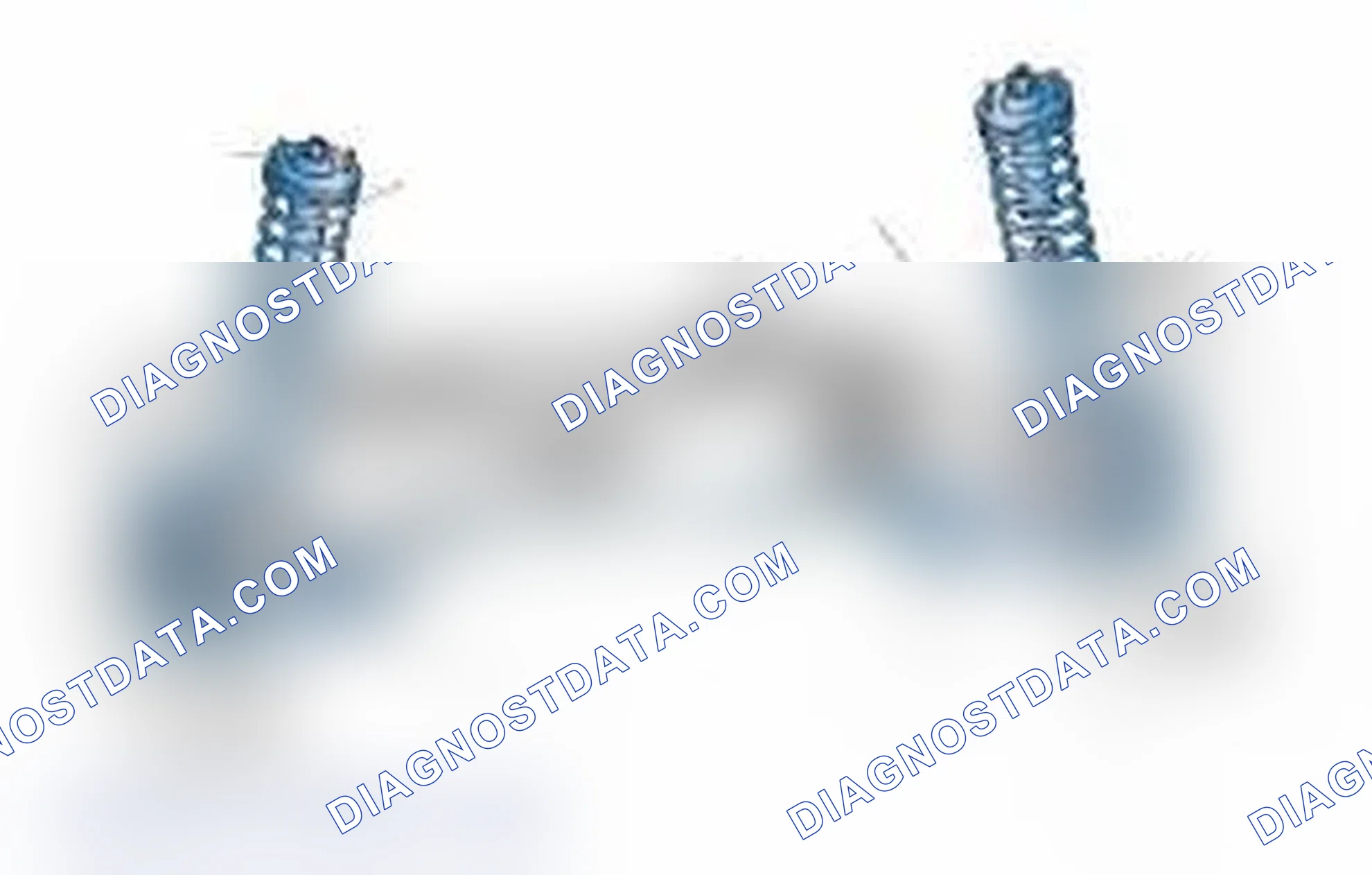 Scheme 25: Typical Front Suspension & Steering Components